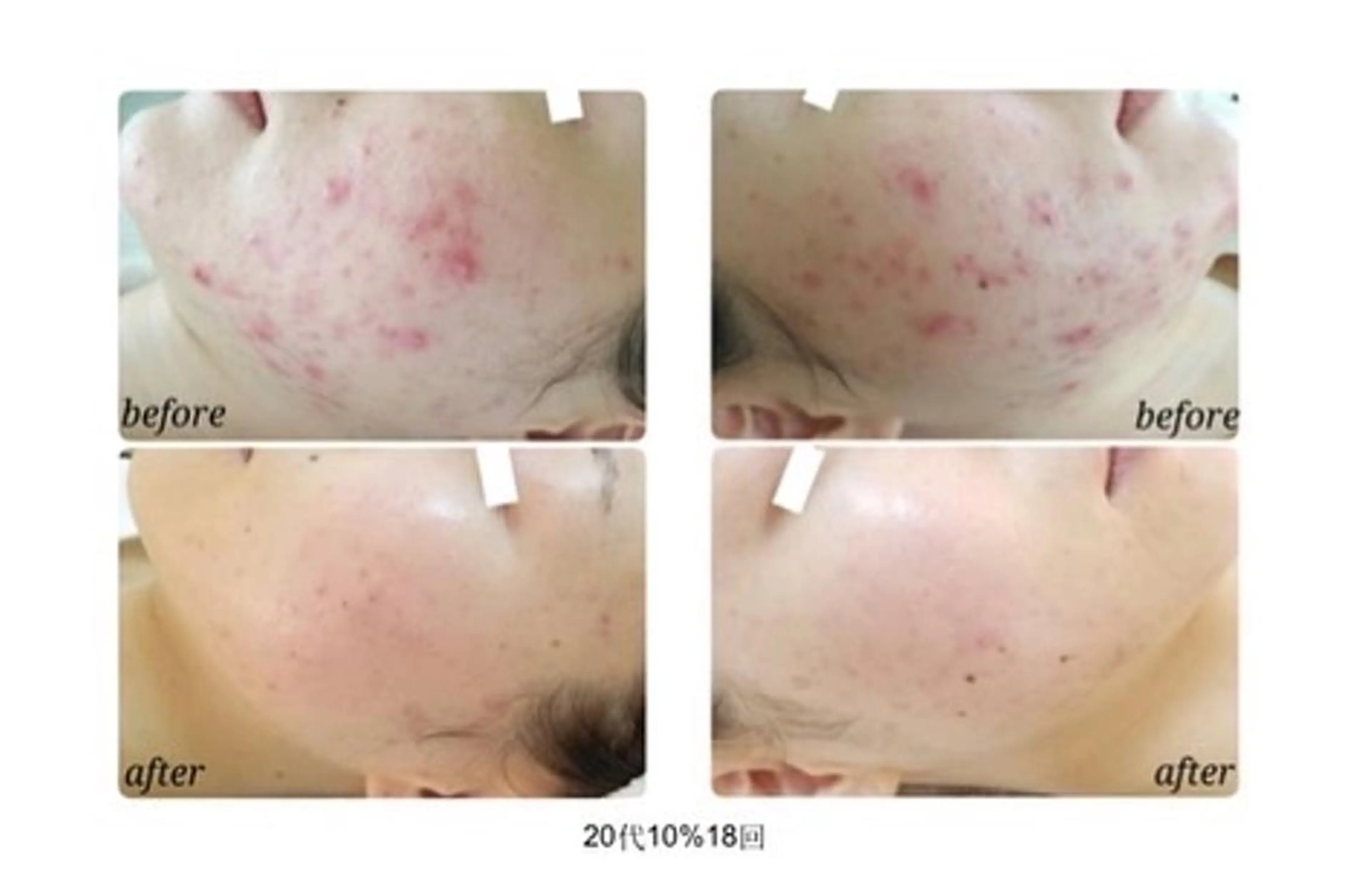 noel de mi 前川亜里沙のエステ・リラクイメージ