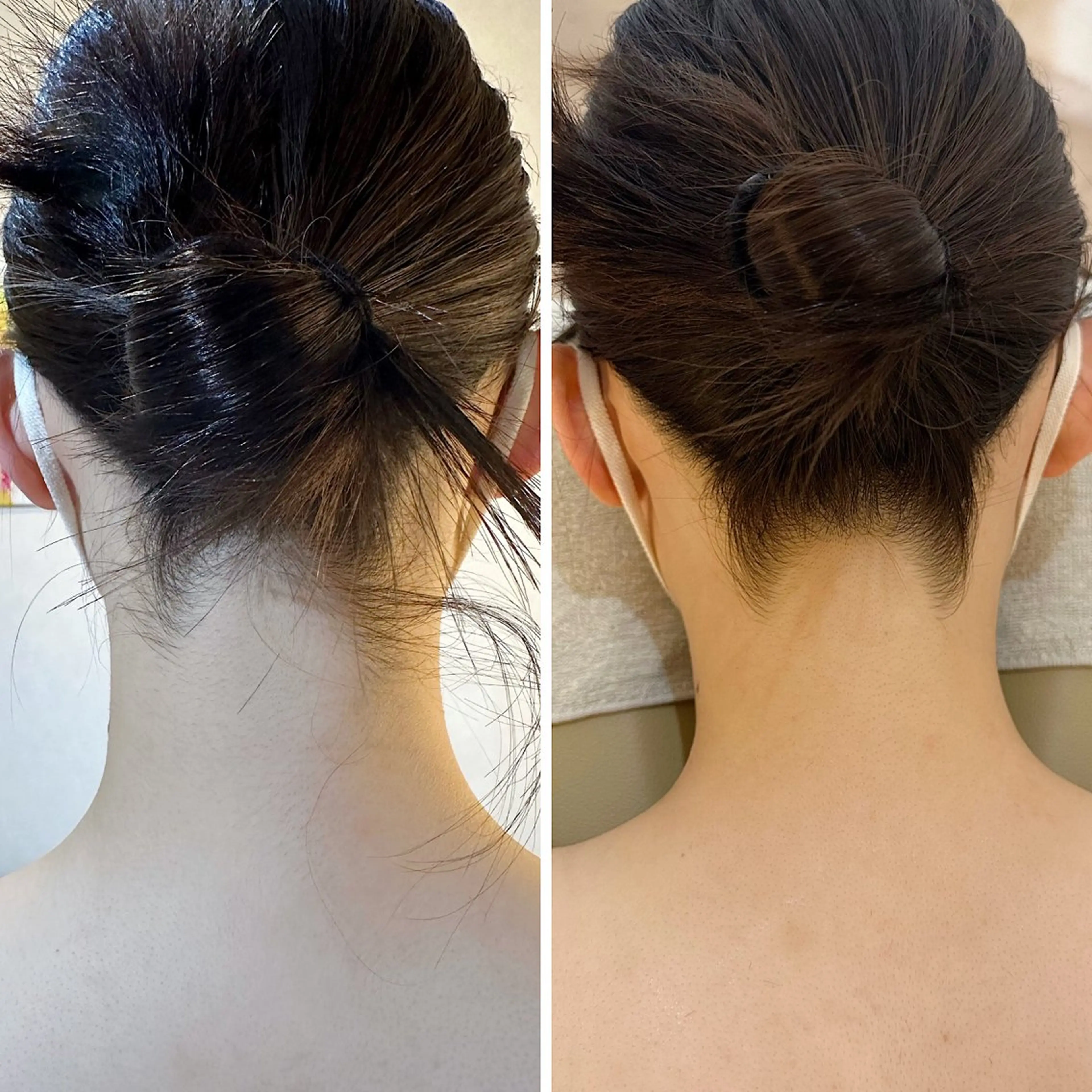 脱毛 うなじ脱毛/美肌脱毛 LABELのエステ・リラクイメージ