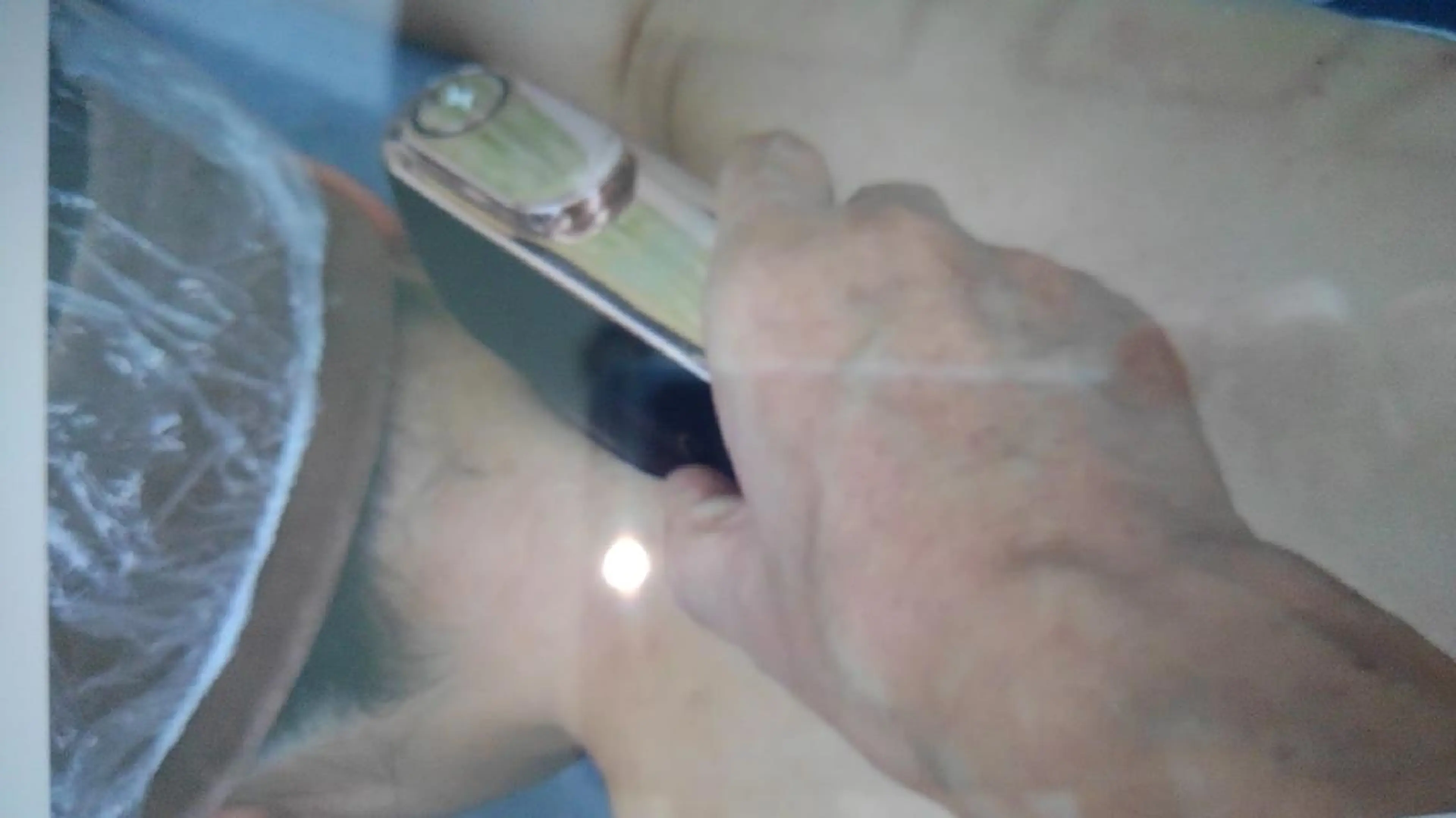 うなじの脱毛の写真