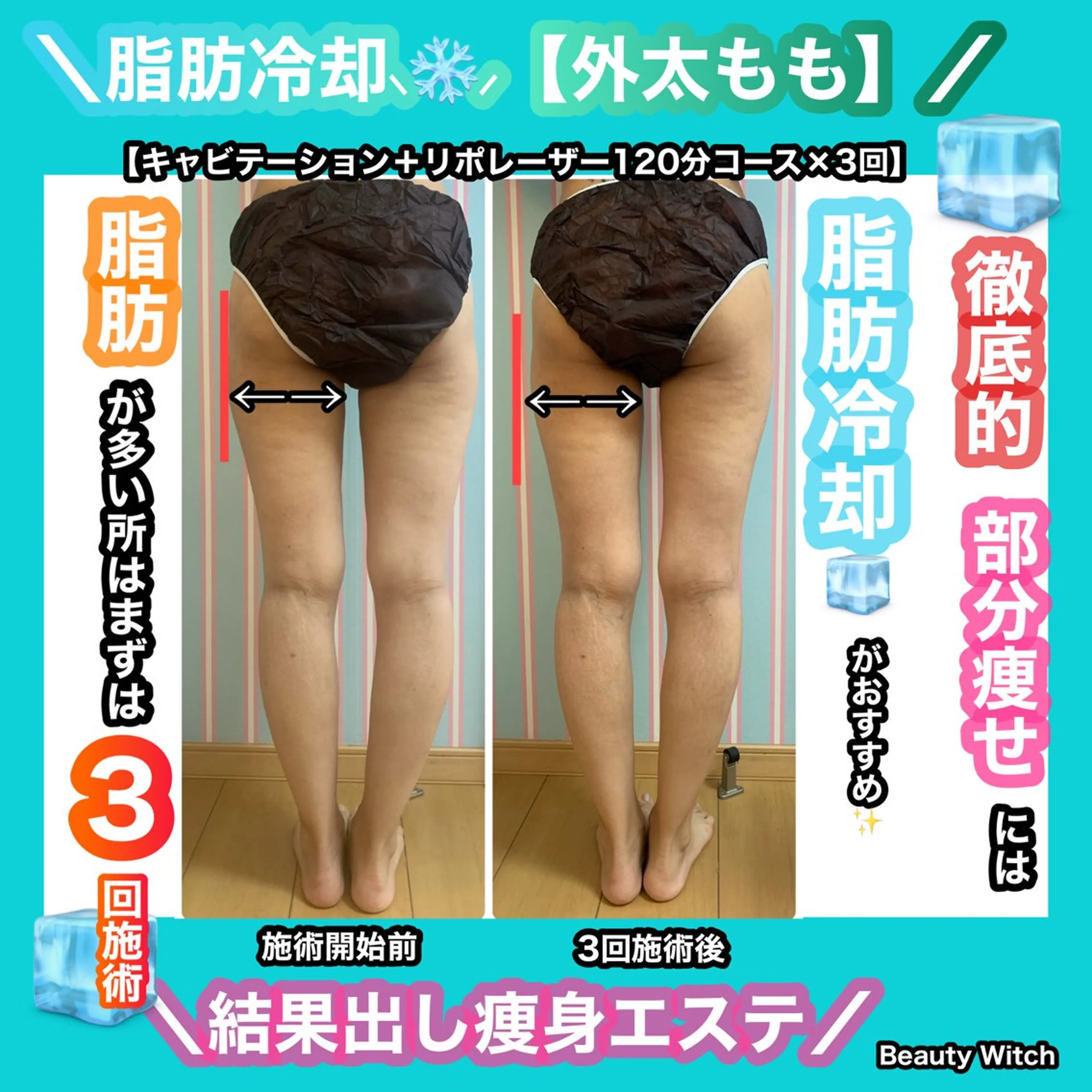 エステ 痩身/脱毛/ネイル HARUKAのエステ・リラクイメージ