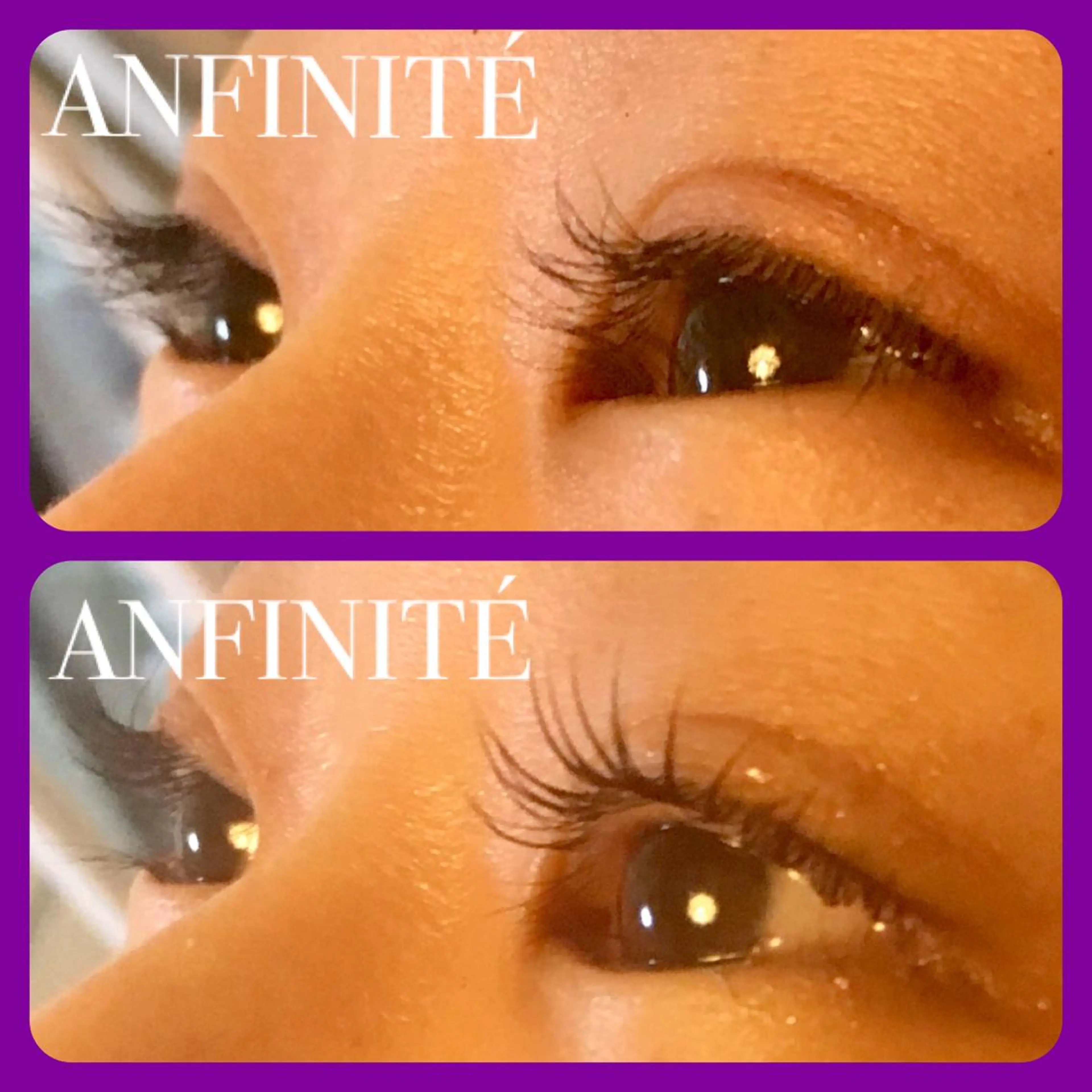 マツエク・マツパ ANFINITÉ所属・ANFINITÉ アンフィニテのエステ・リラクイメージ