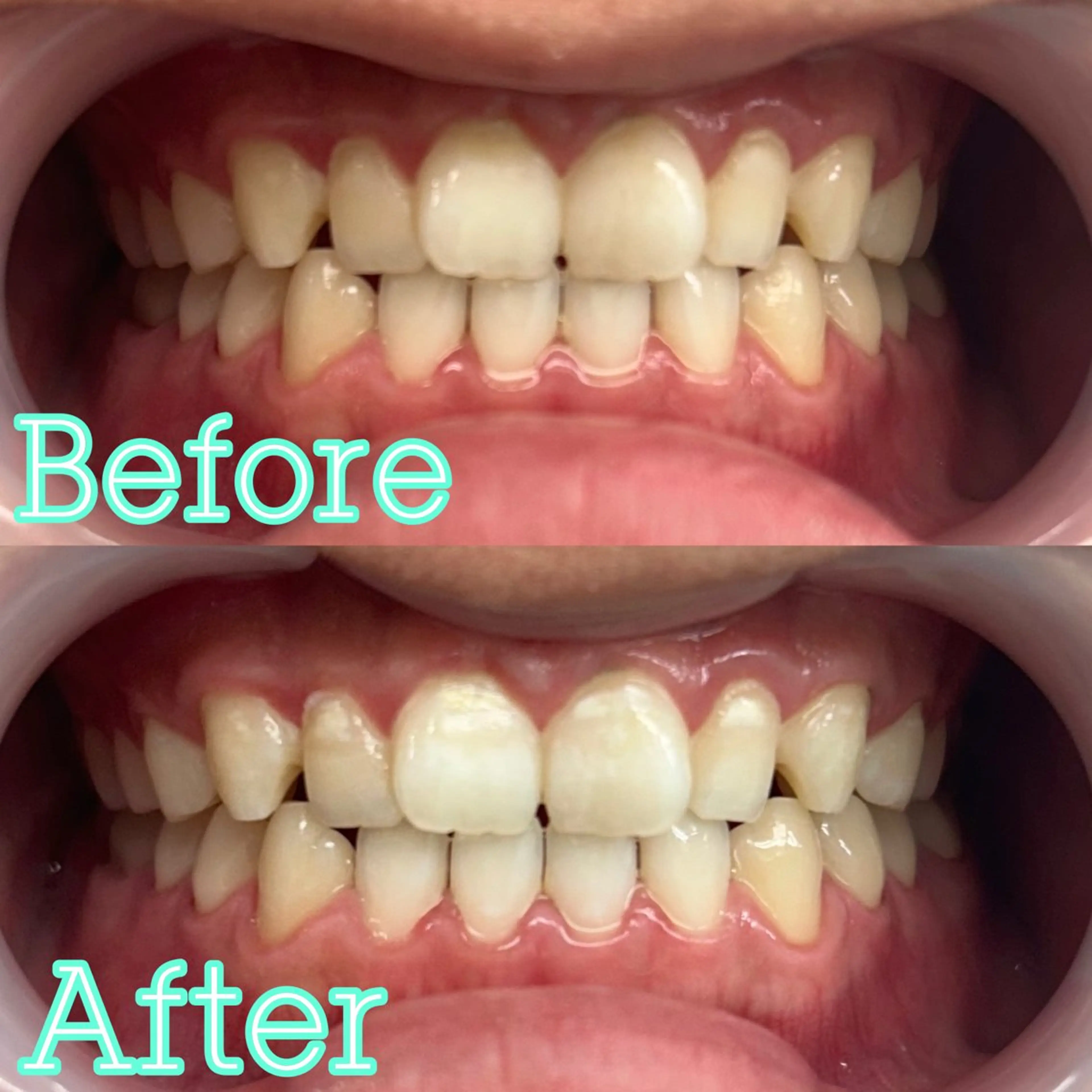 歯のホワイトニング専門店 MIGAQ 京都四条大宮店所属・佐藤 未来の眉毛・アイブロウイメージ