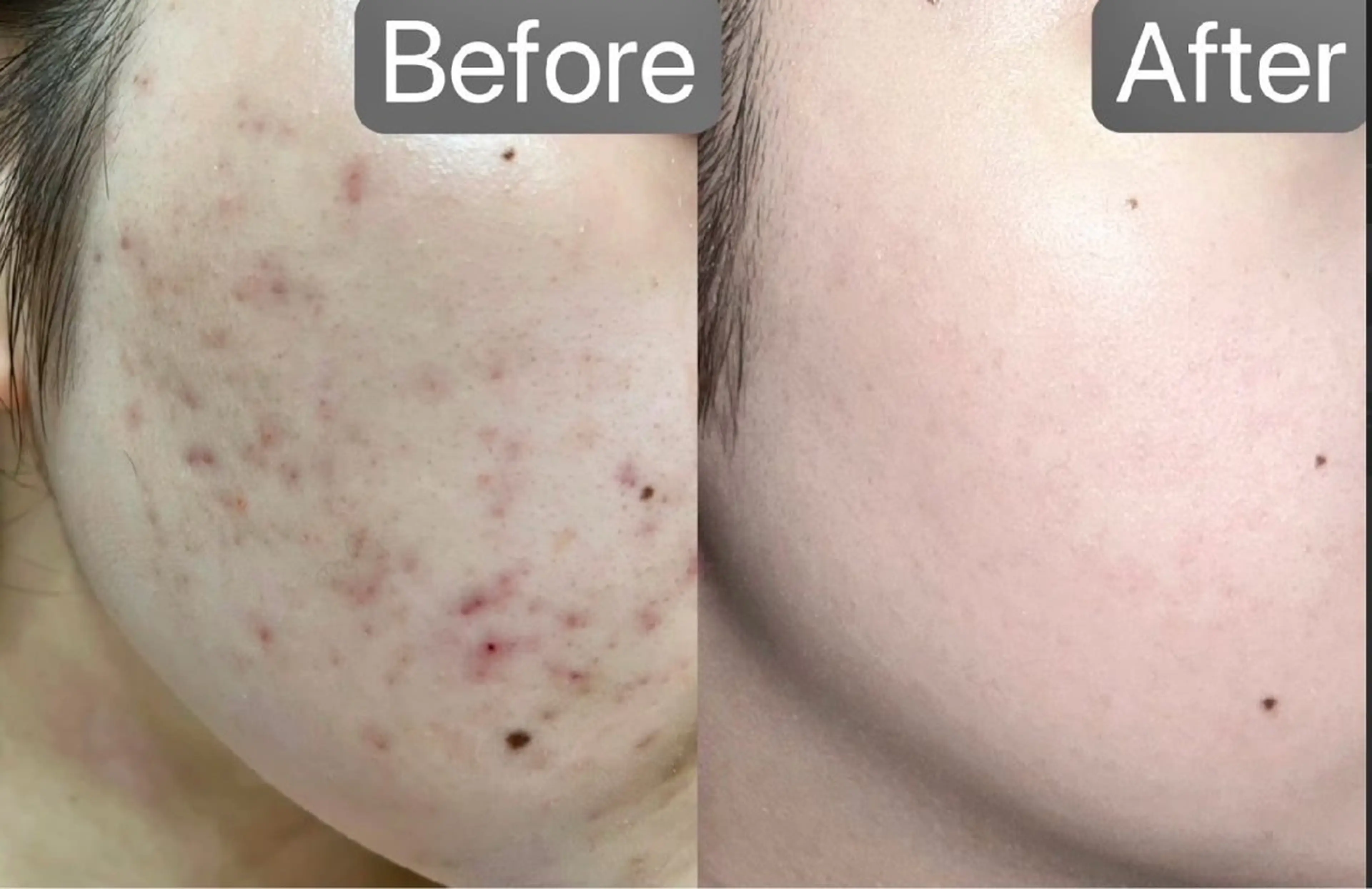 エステ 韓国肌管理Belle後楽園所属・韓国肌管理Belle 後楽園のエステ・リラクイメージ