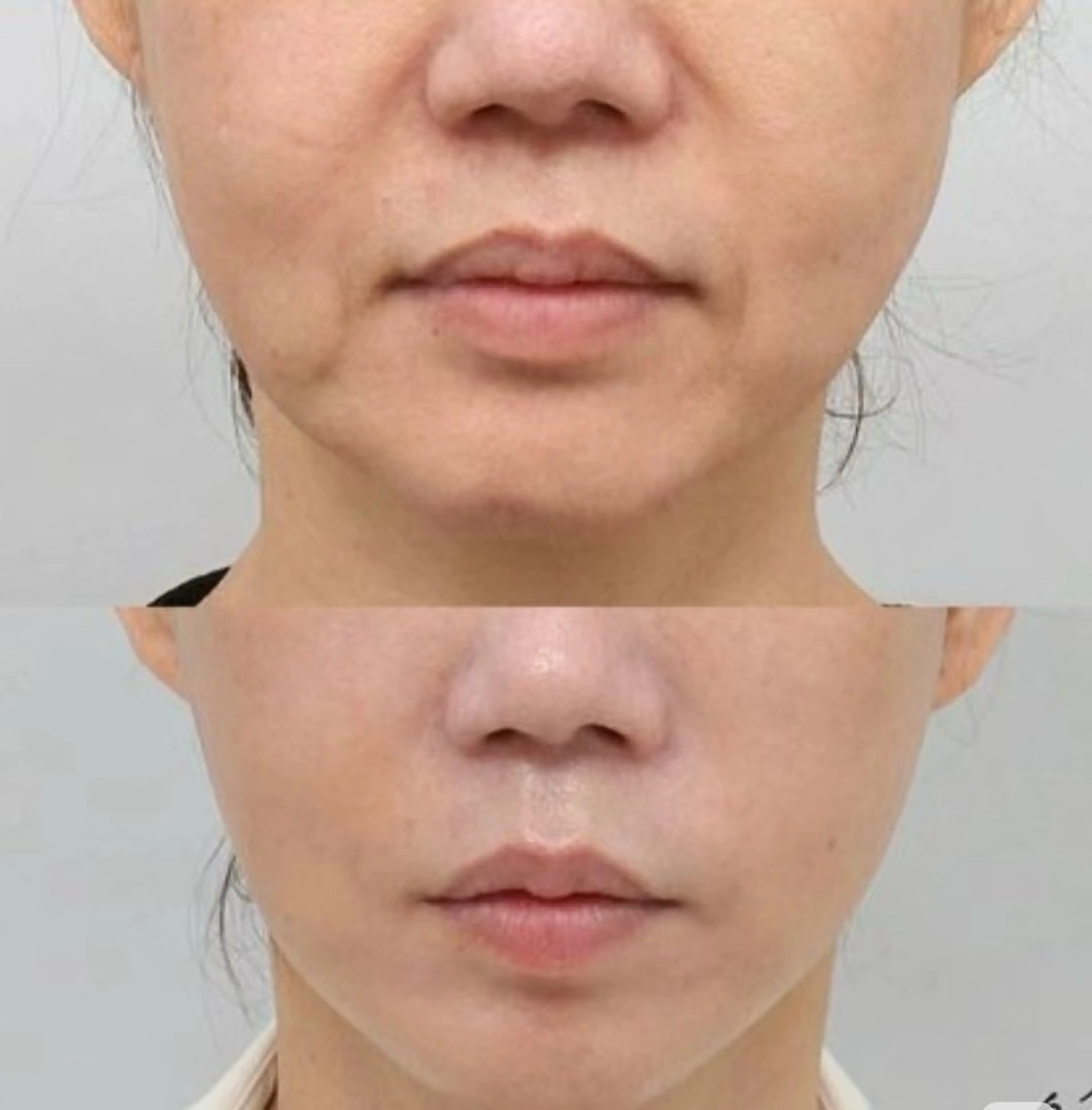 マツエク・マツパ エステ aliaハイフ&水光ジェットサロン所属・aliaハーブ水光店 エステティシャン募集のエステ・リラクイメージ