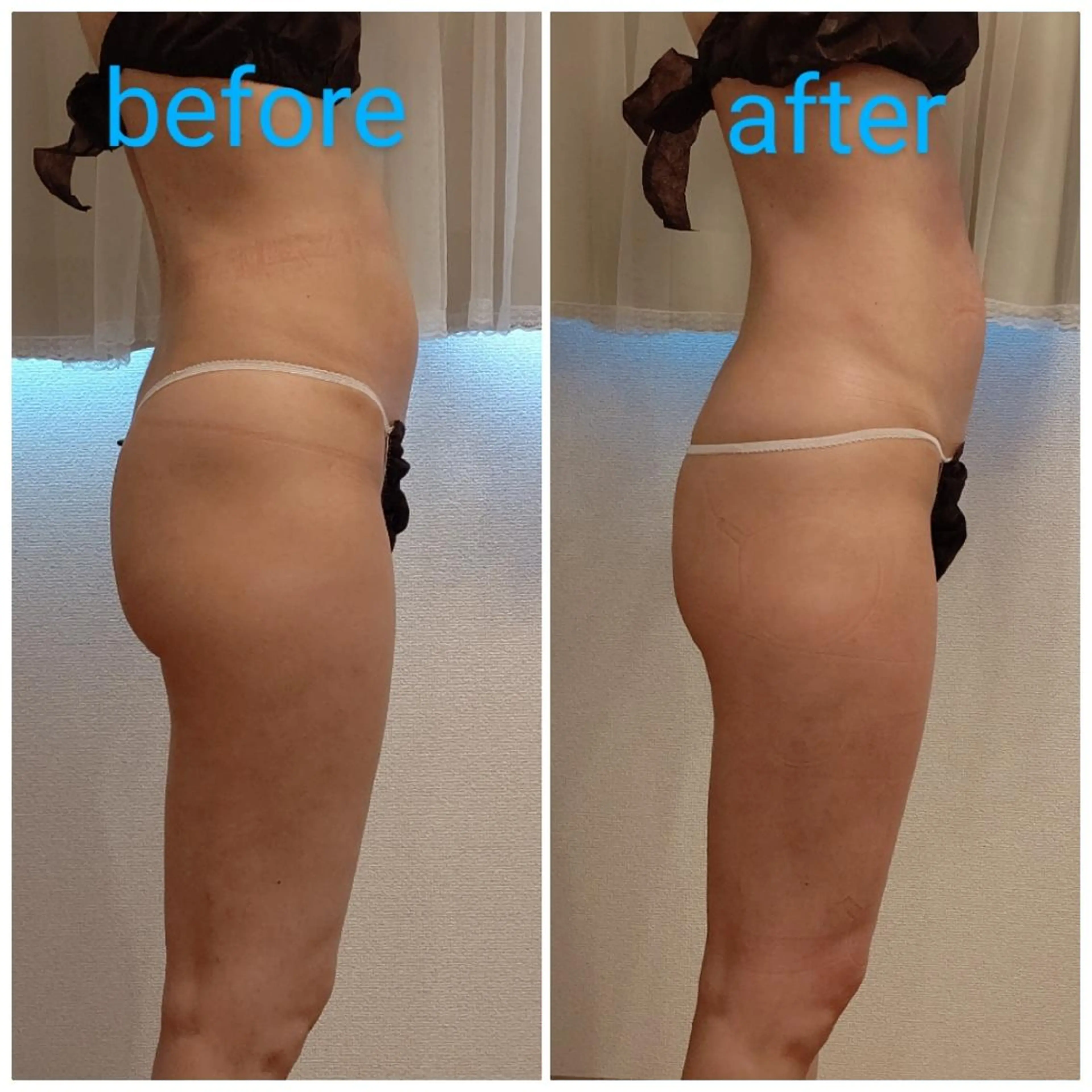 エステ トータルビューティー サロン　Reiのエステ・リラクイメージ