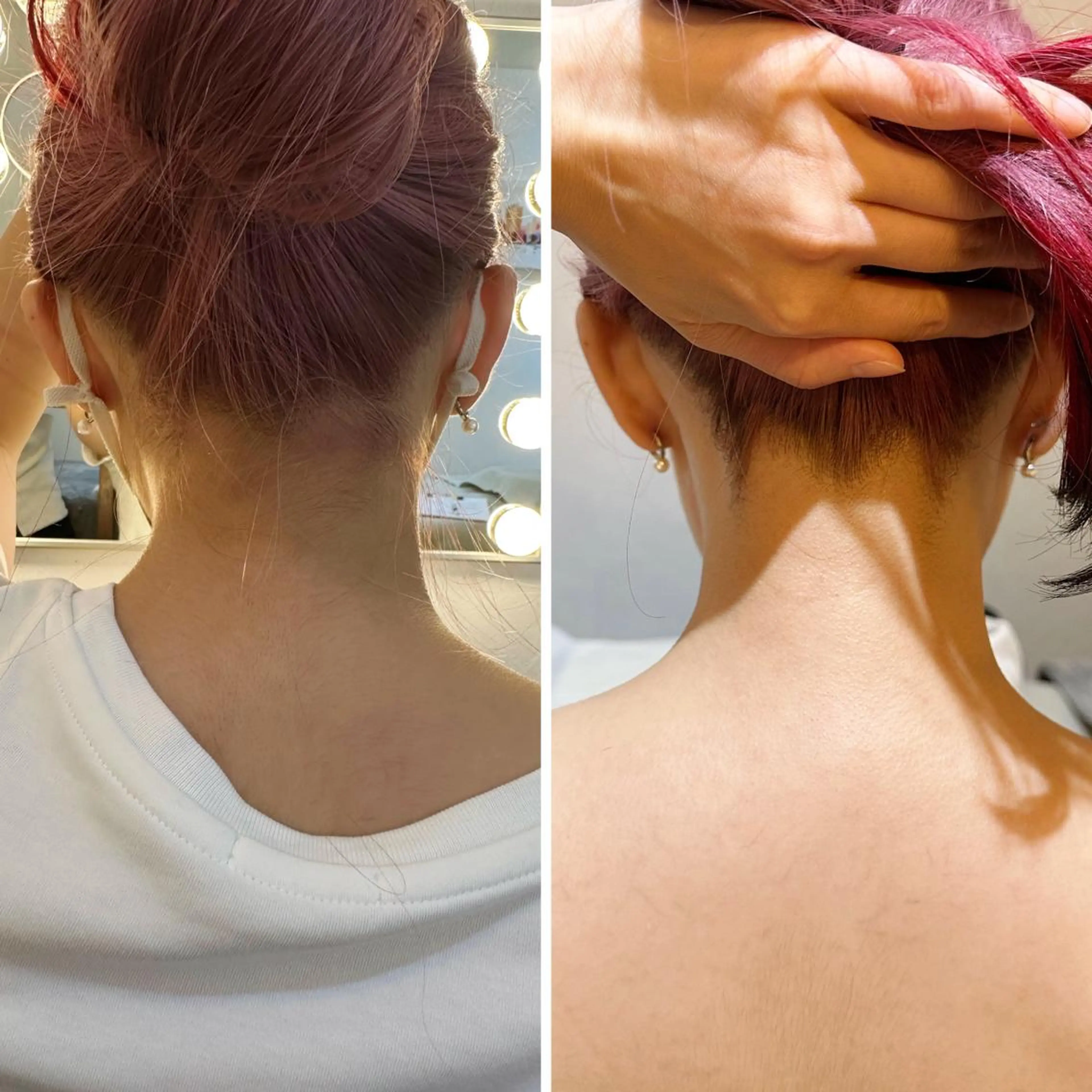 うなじ脱毛/美肌脱毛 LABELのエステ・リラクイメージ