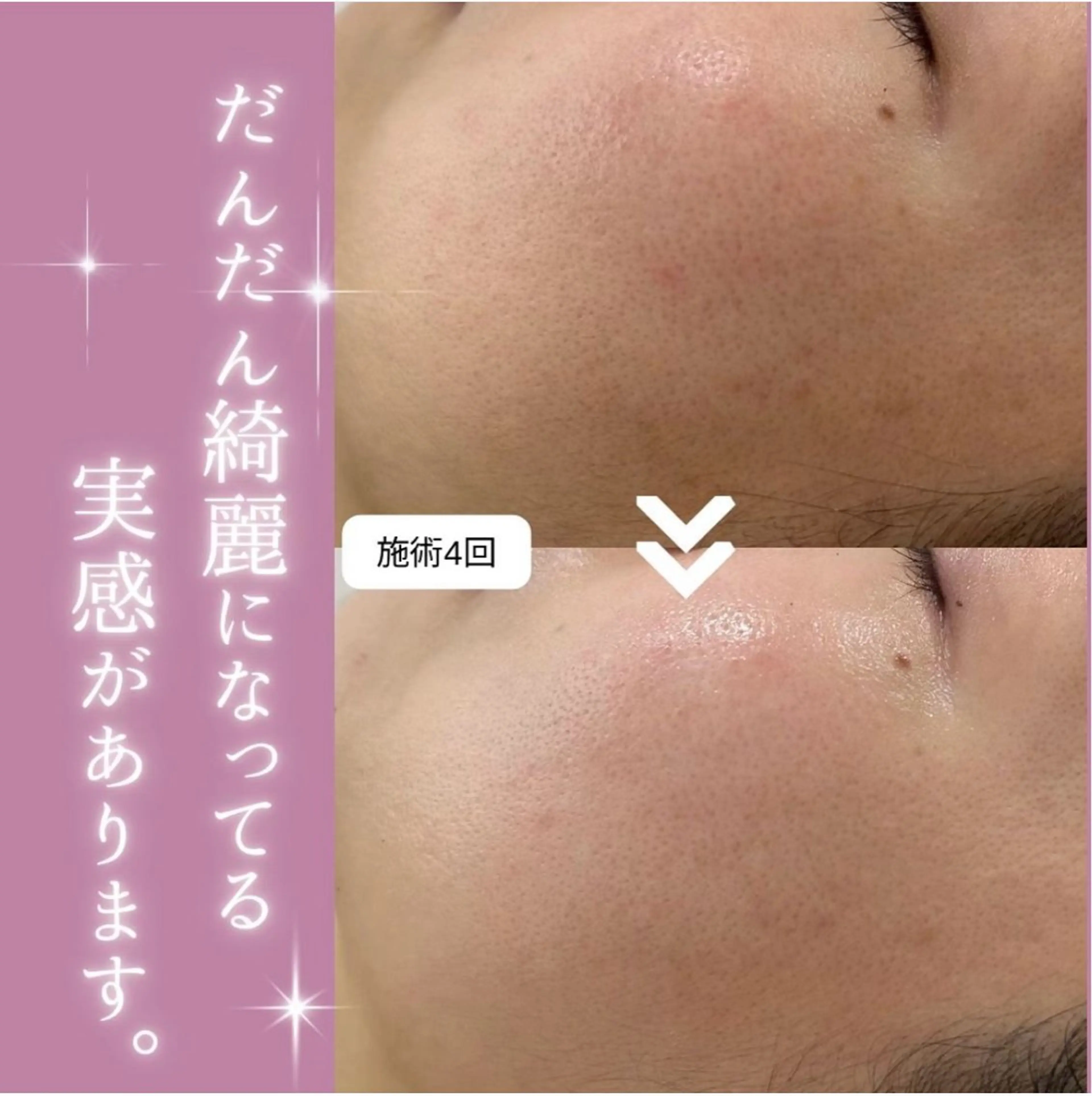 【現役看護師】高来 笑子のエステ・リラクイメージ