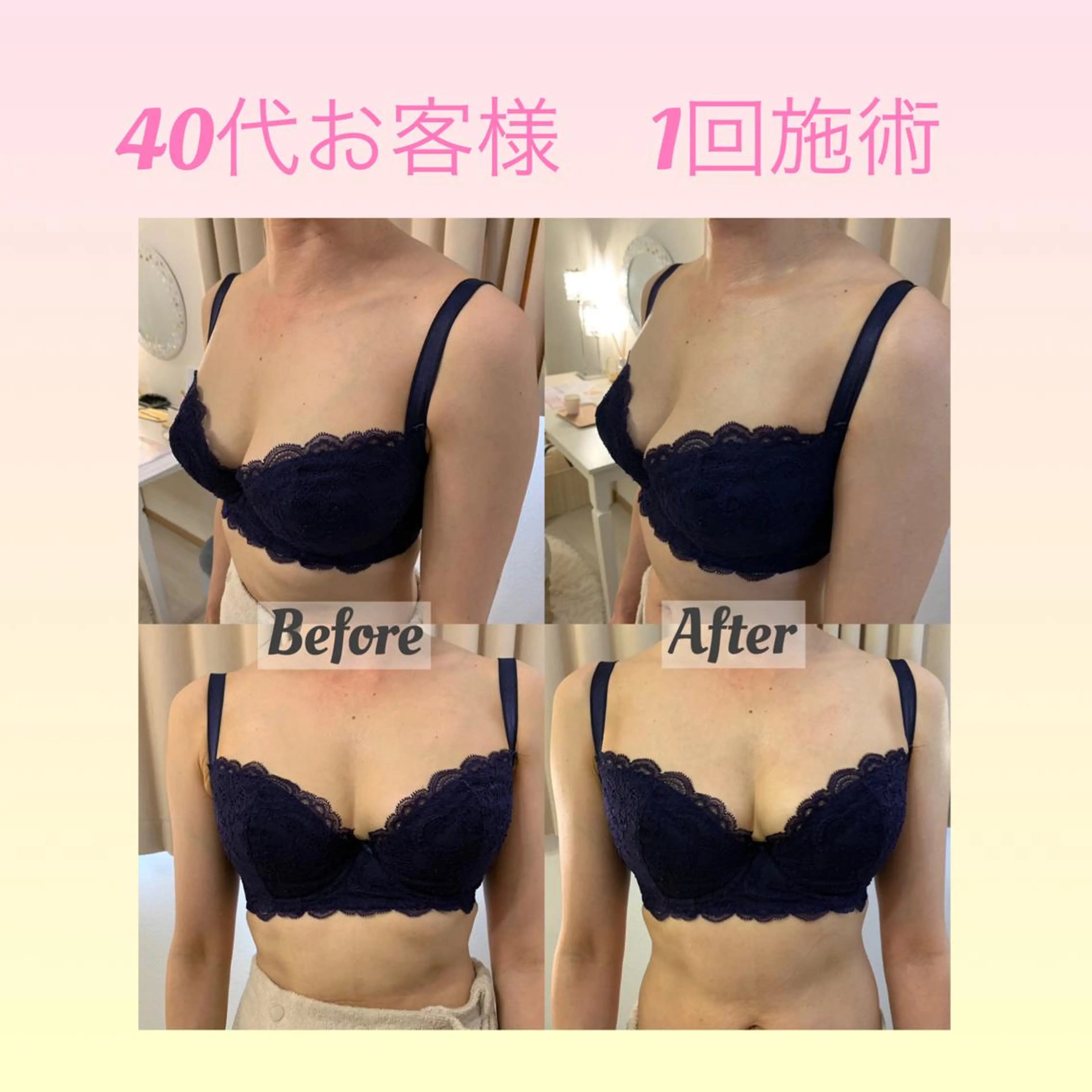 Ele’na バスト&フェイシャルのエステ・リラクイメージ