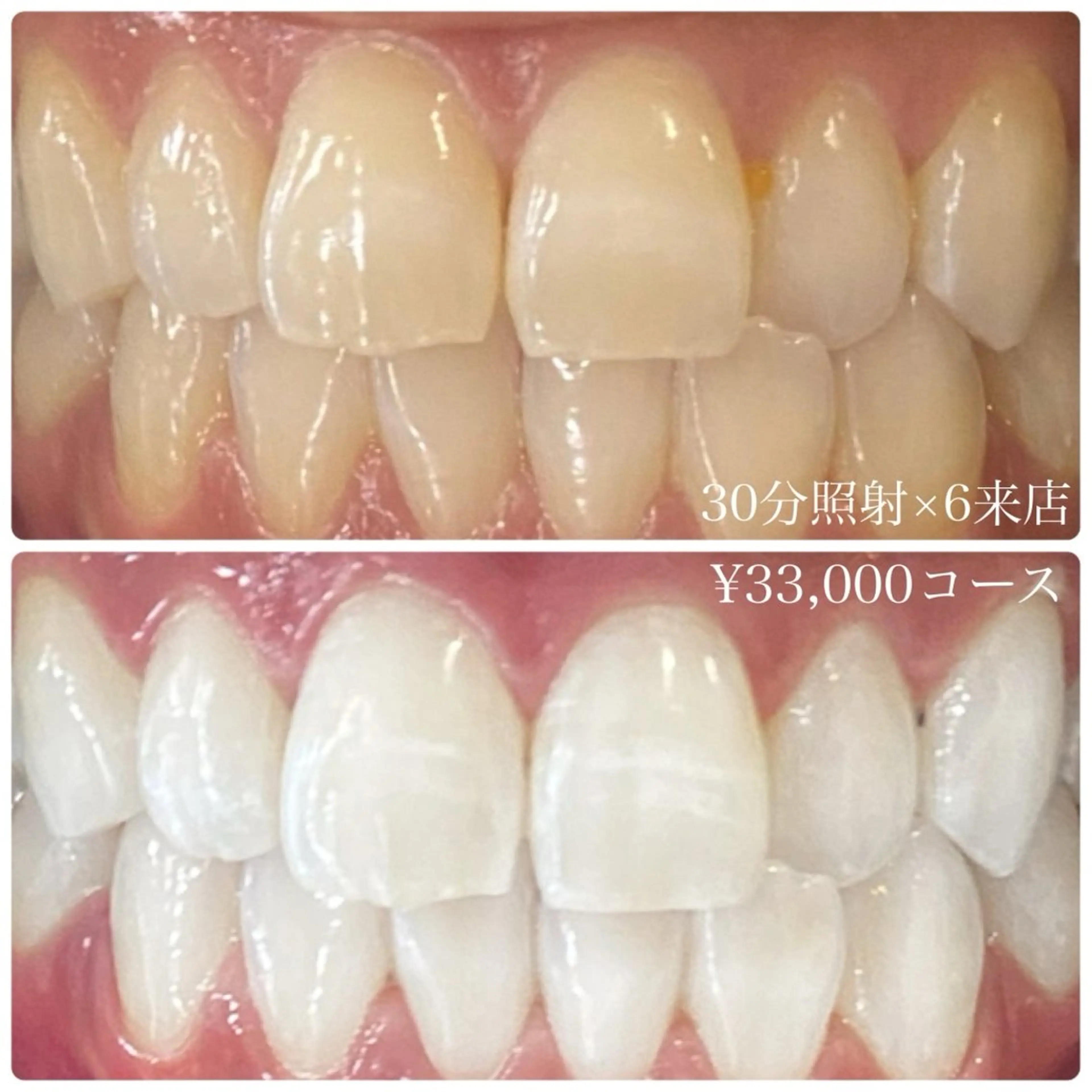 PLATINUM Beauty 横浜店所属・ホワイトニングルーム 横浜店のその他イメージ