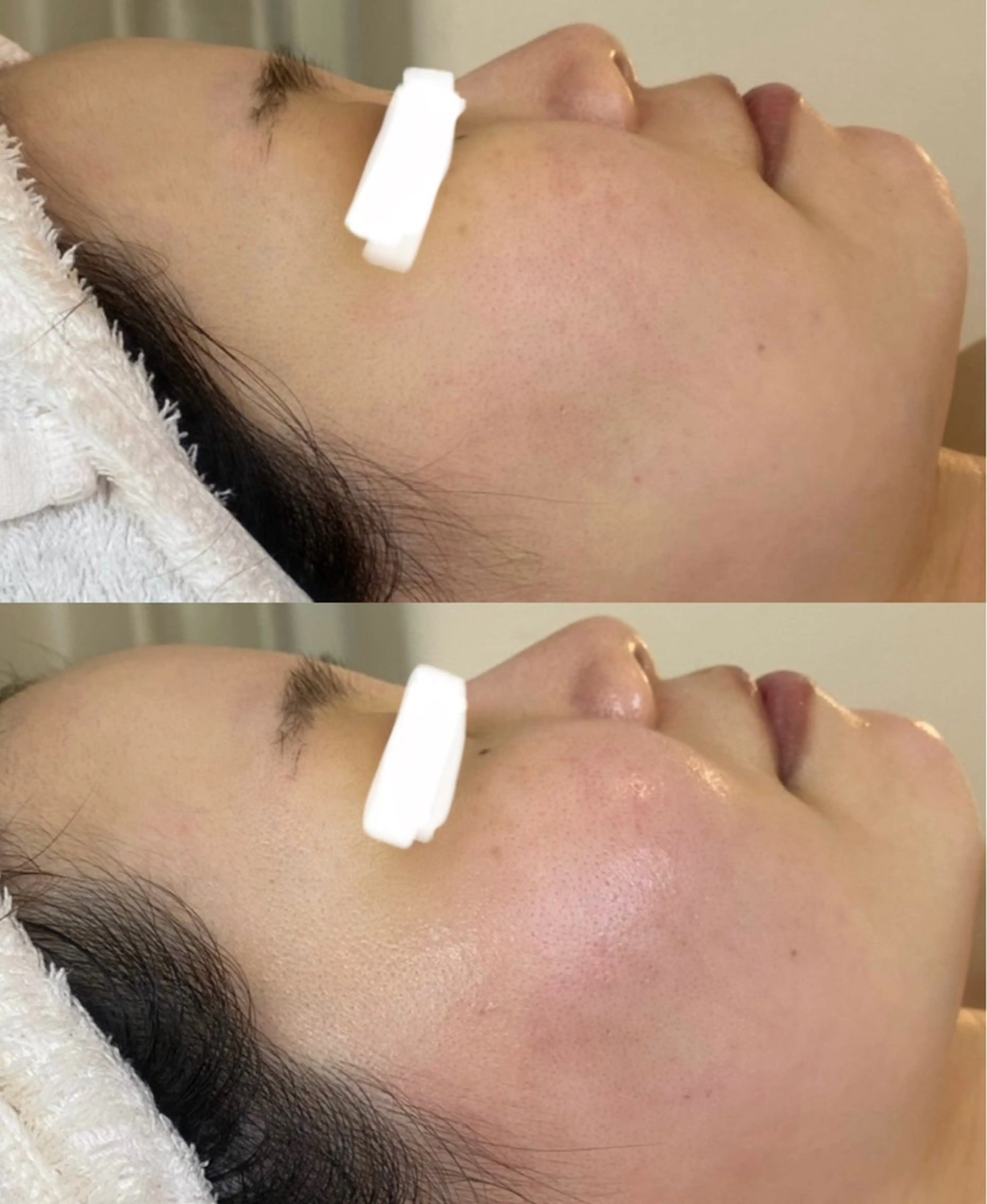 田中For..天王寺 肌質改善/よもぎ蒸しのエステ・リラクイメージ