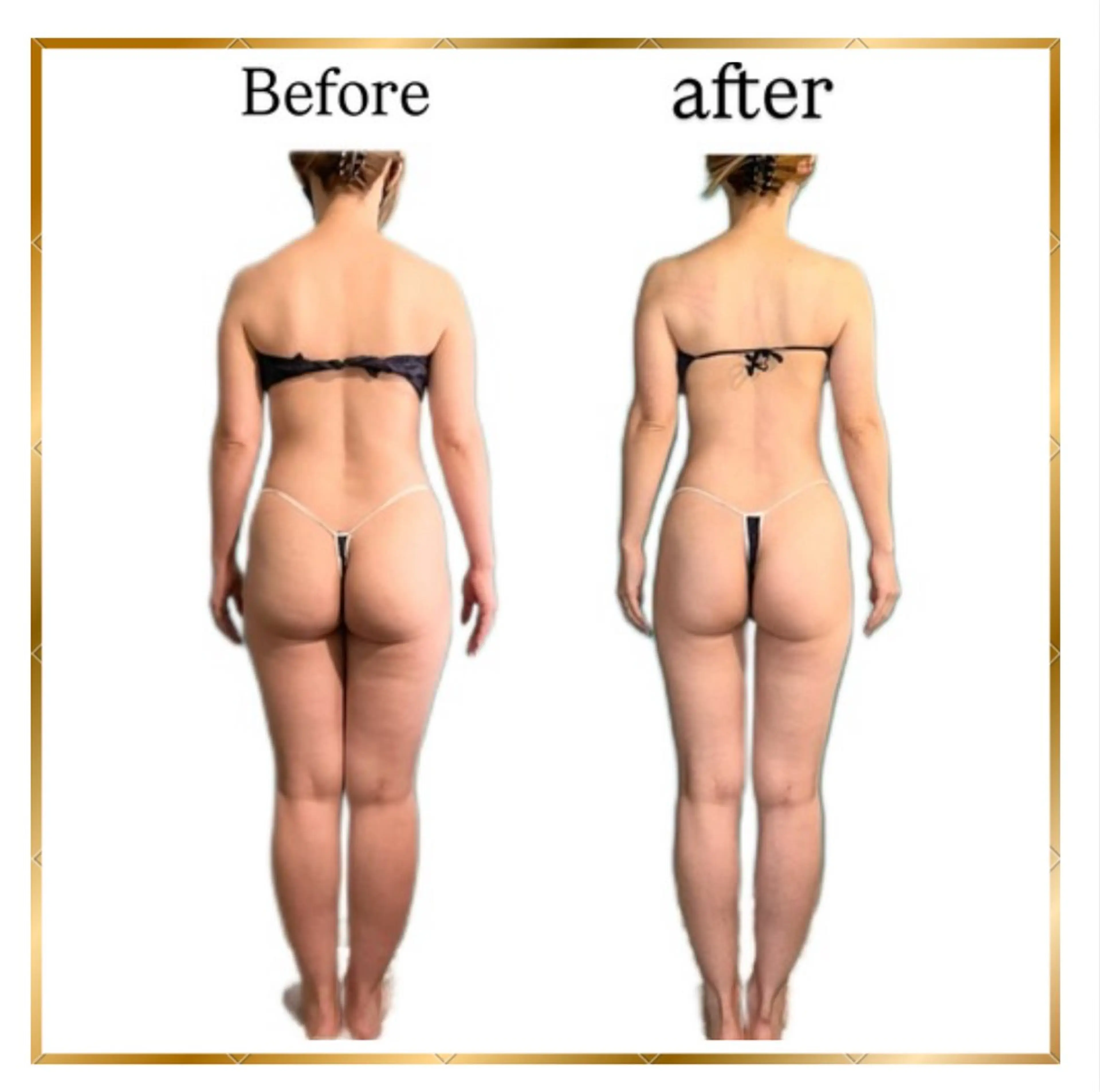 身体の重だるさや全身のむくみ解消『全身ケア』の写真