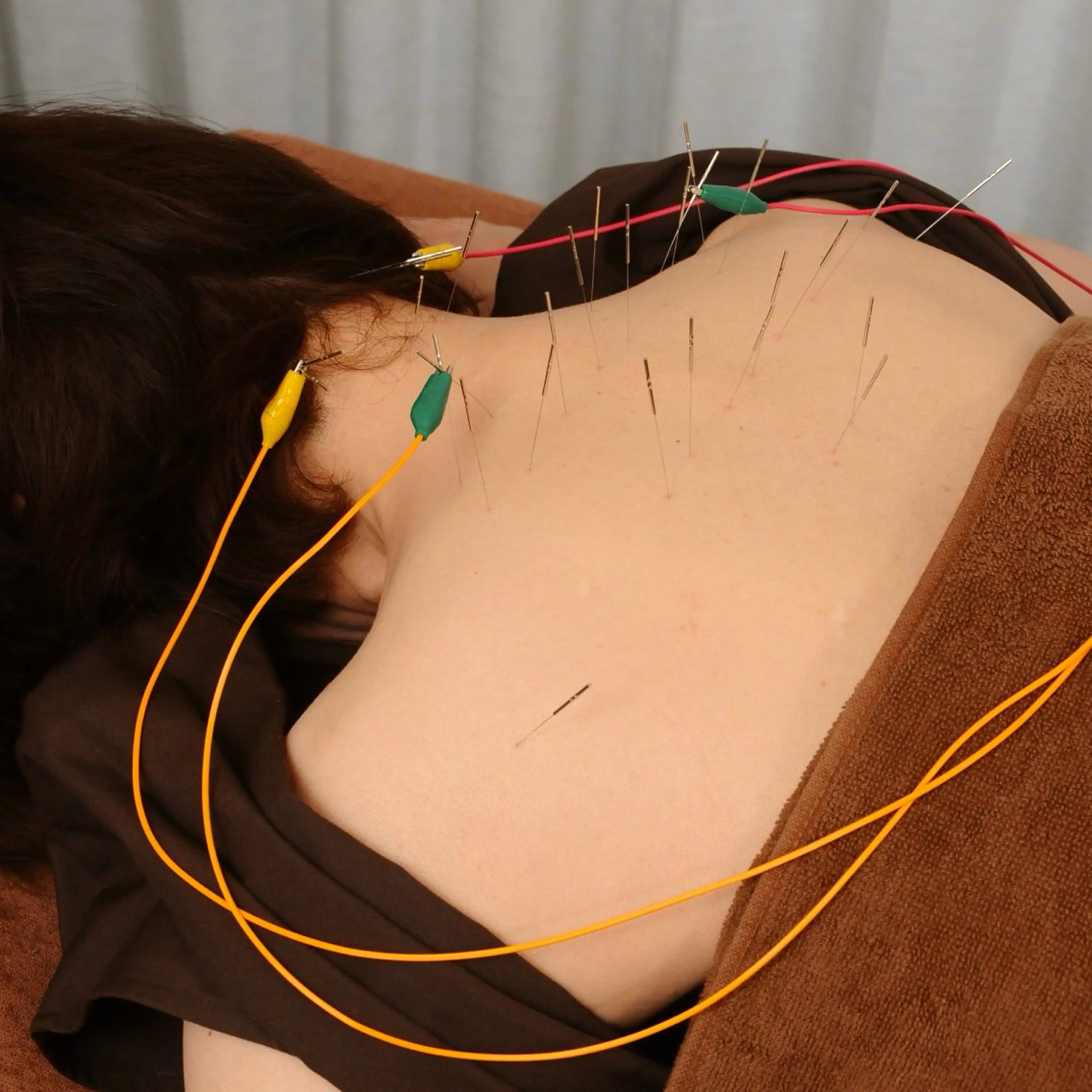 Spring鍼灸院所属・Spring鍼灸院 ✨首肩こり、腰痛に！のエステ・リラクイメージ