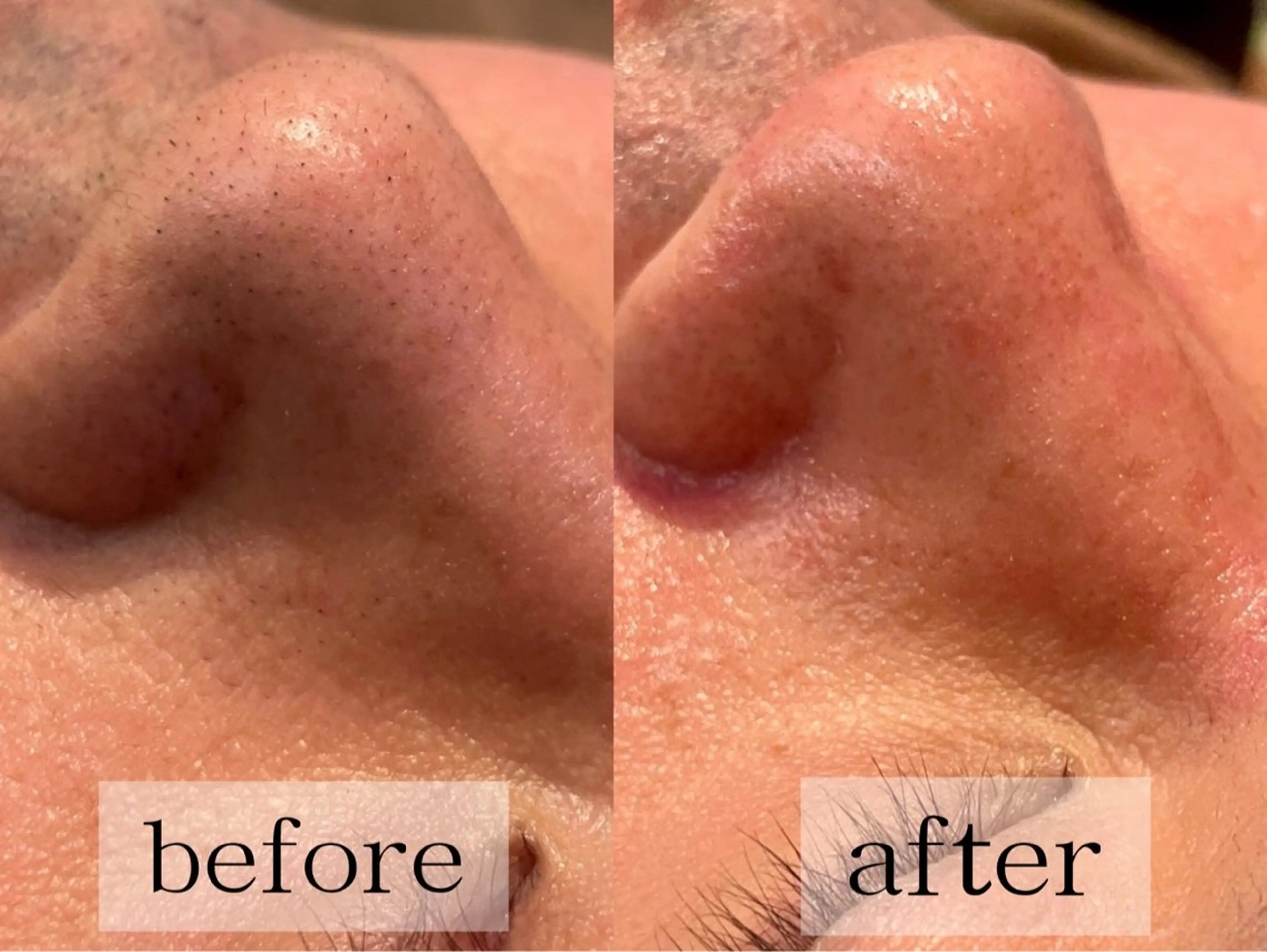 毛穴・肌質ケア専門 グランビューティーのエステ・リラクイメージ