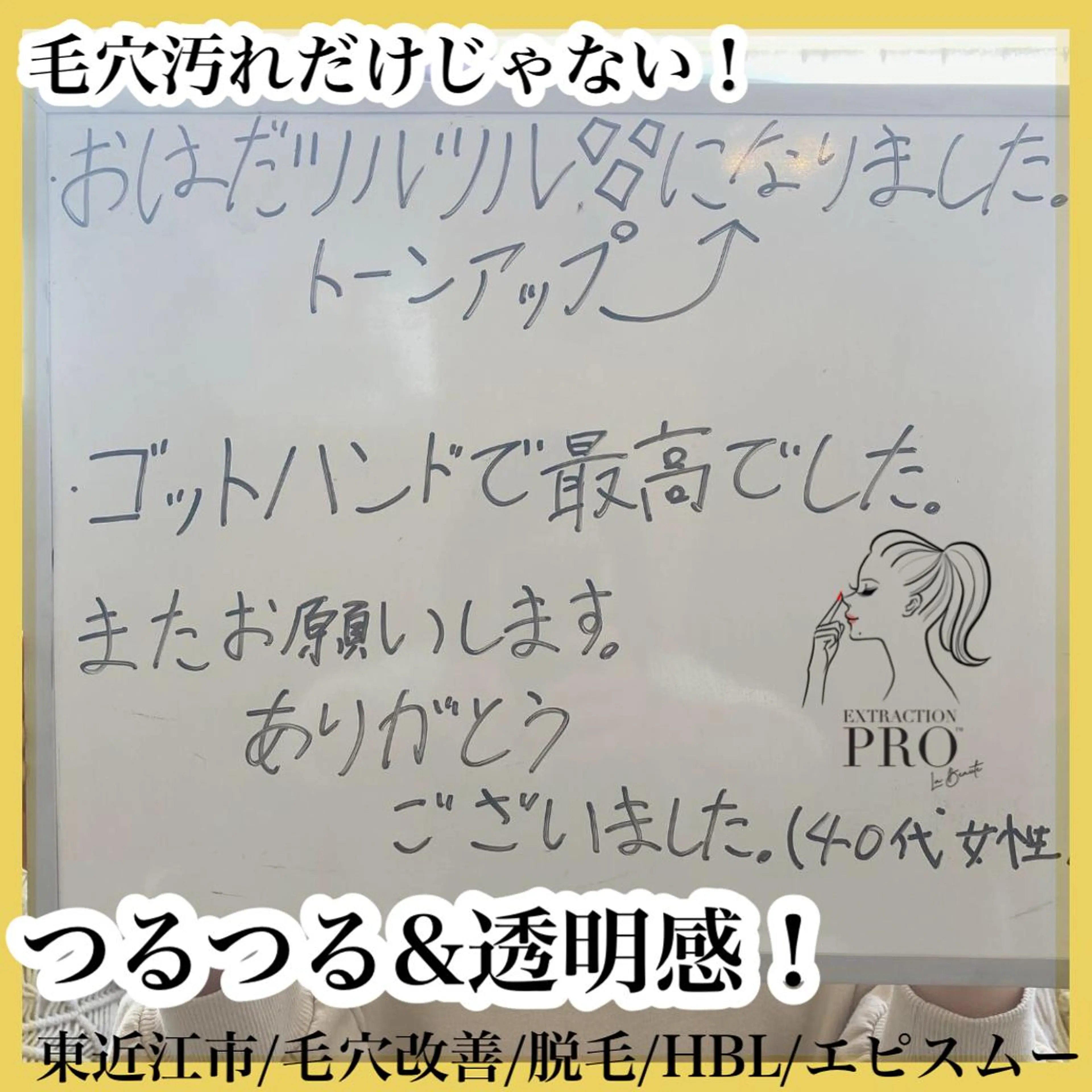 epismoo 脱毛/HBL/毛穴の眉毛・アイブロウイメージ