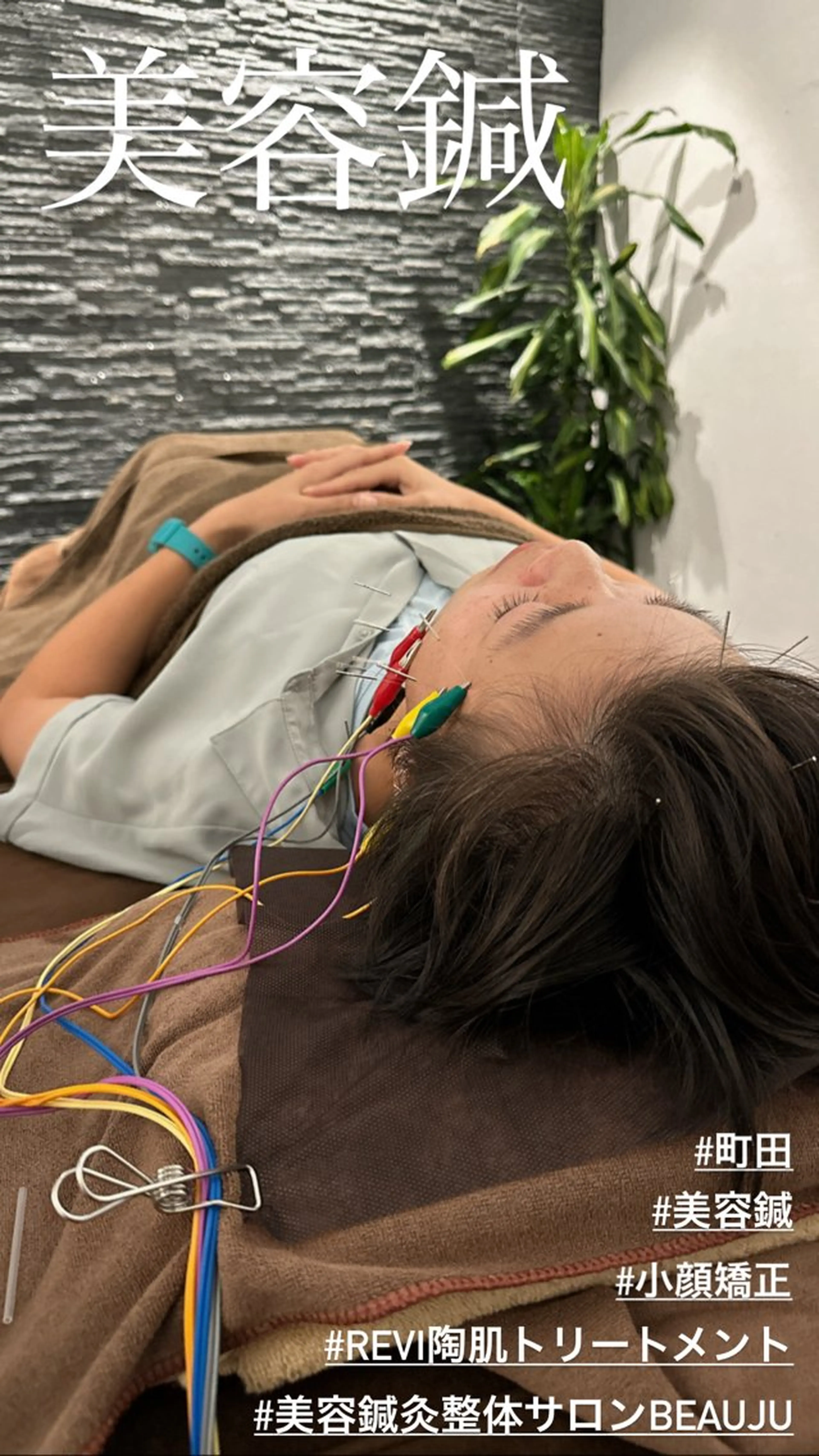 その他 美容鍼灸整体サロンBeauJu所属・小顔矯/美容鍼/鍼灸 BeauJuのその他イメージ