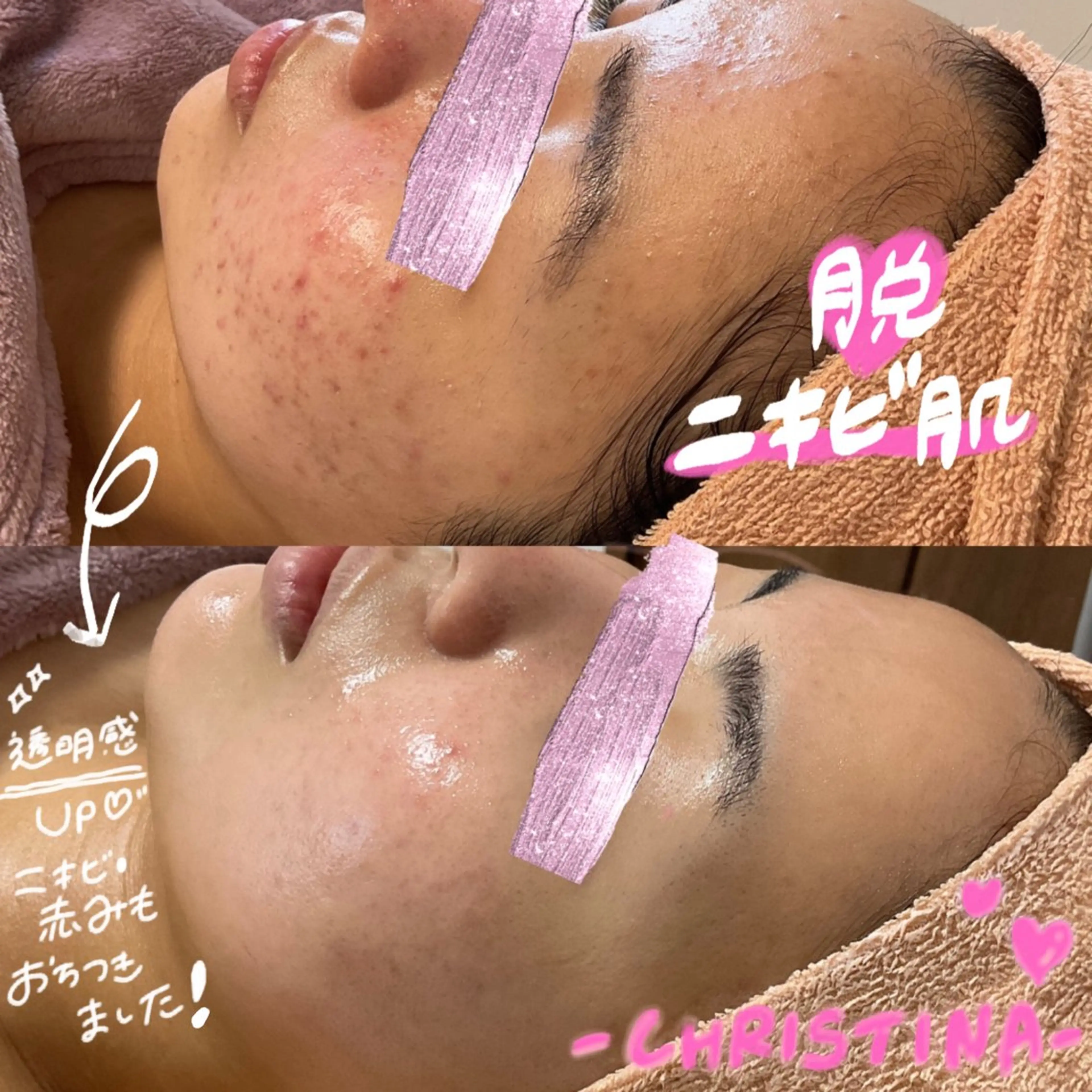 肌質改善サロン ココマヒナのエステ・リラクイメージ