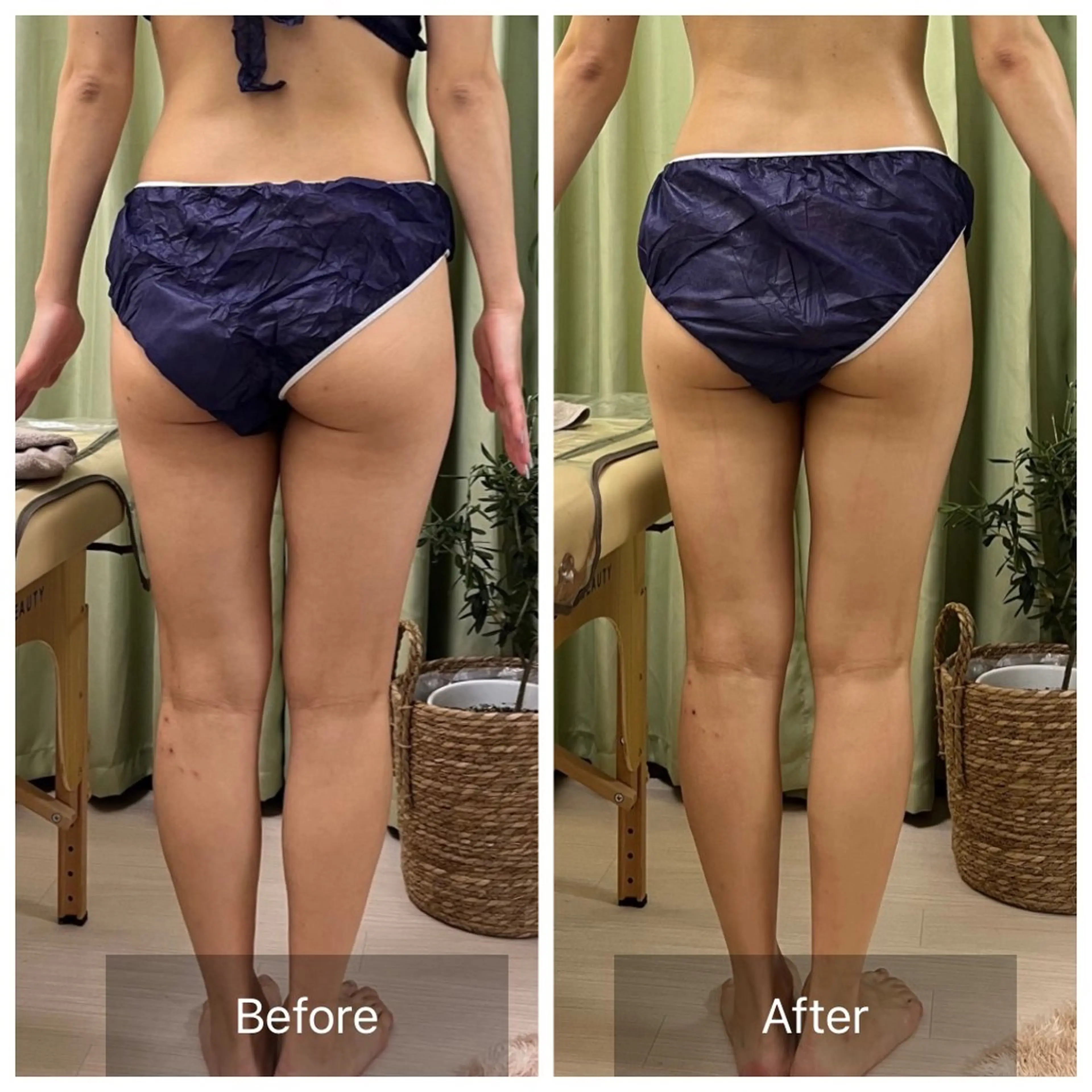 【元に戻らない】 小顔&部分痩せのその他イメージ