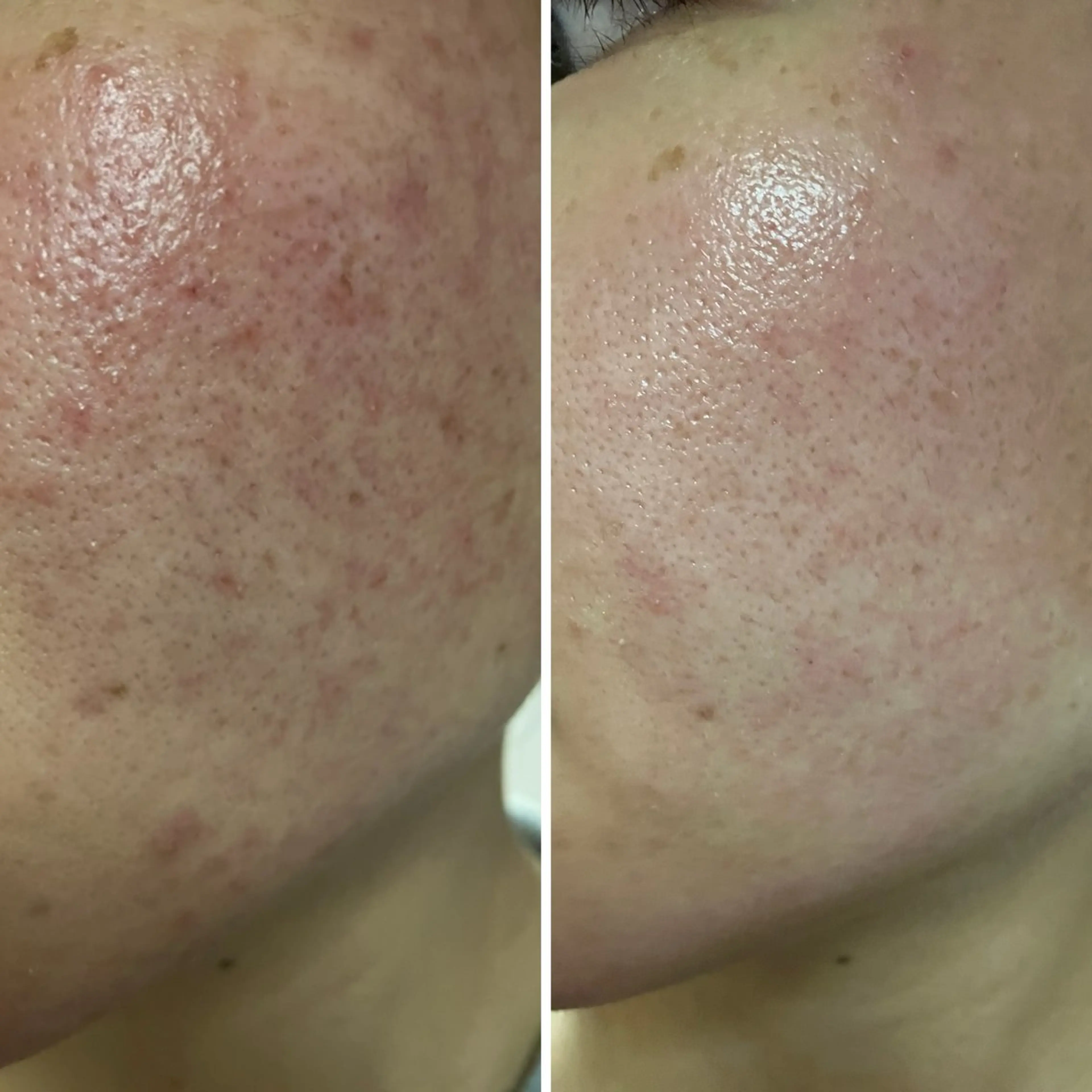 mison所属・mison 安形友花のネイルデザイン