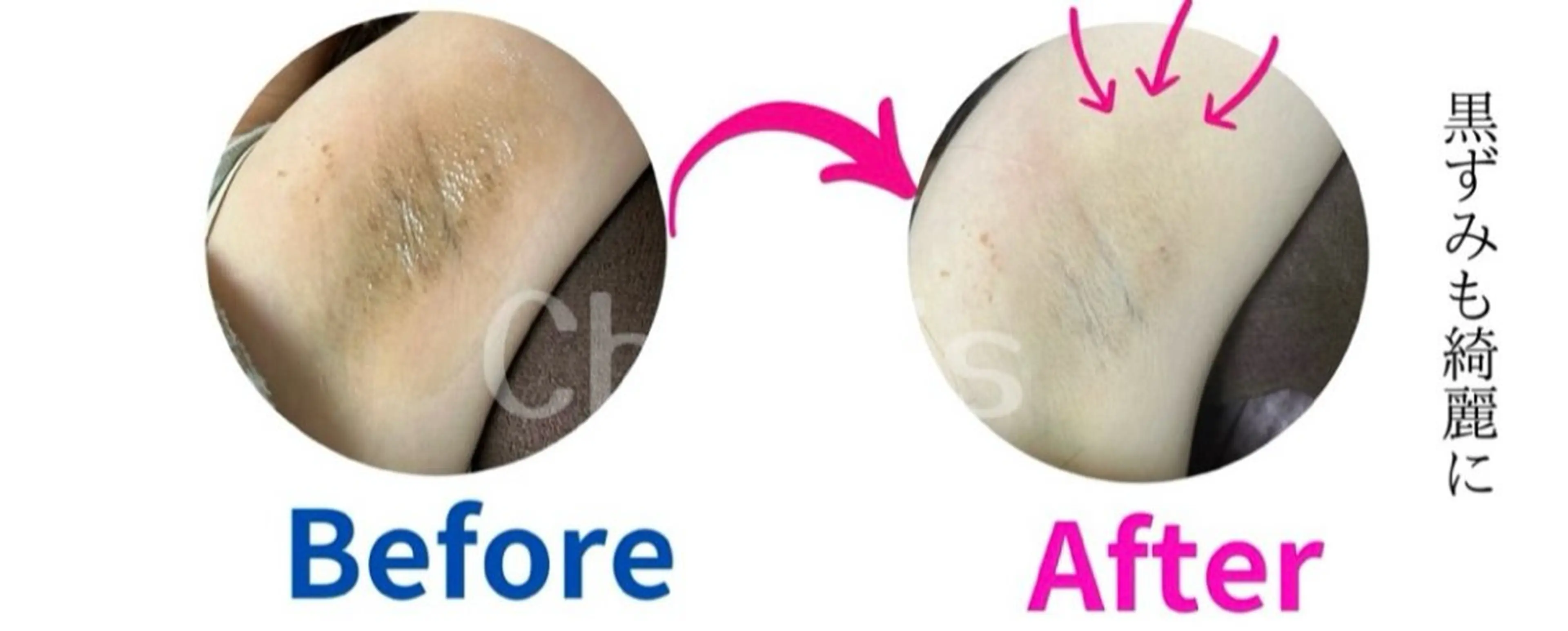 川越ローマピンク 光脱毛＆ワックス脱毛のエステ・リラクイメージ