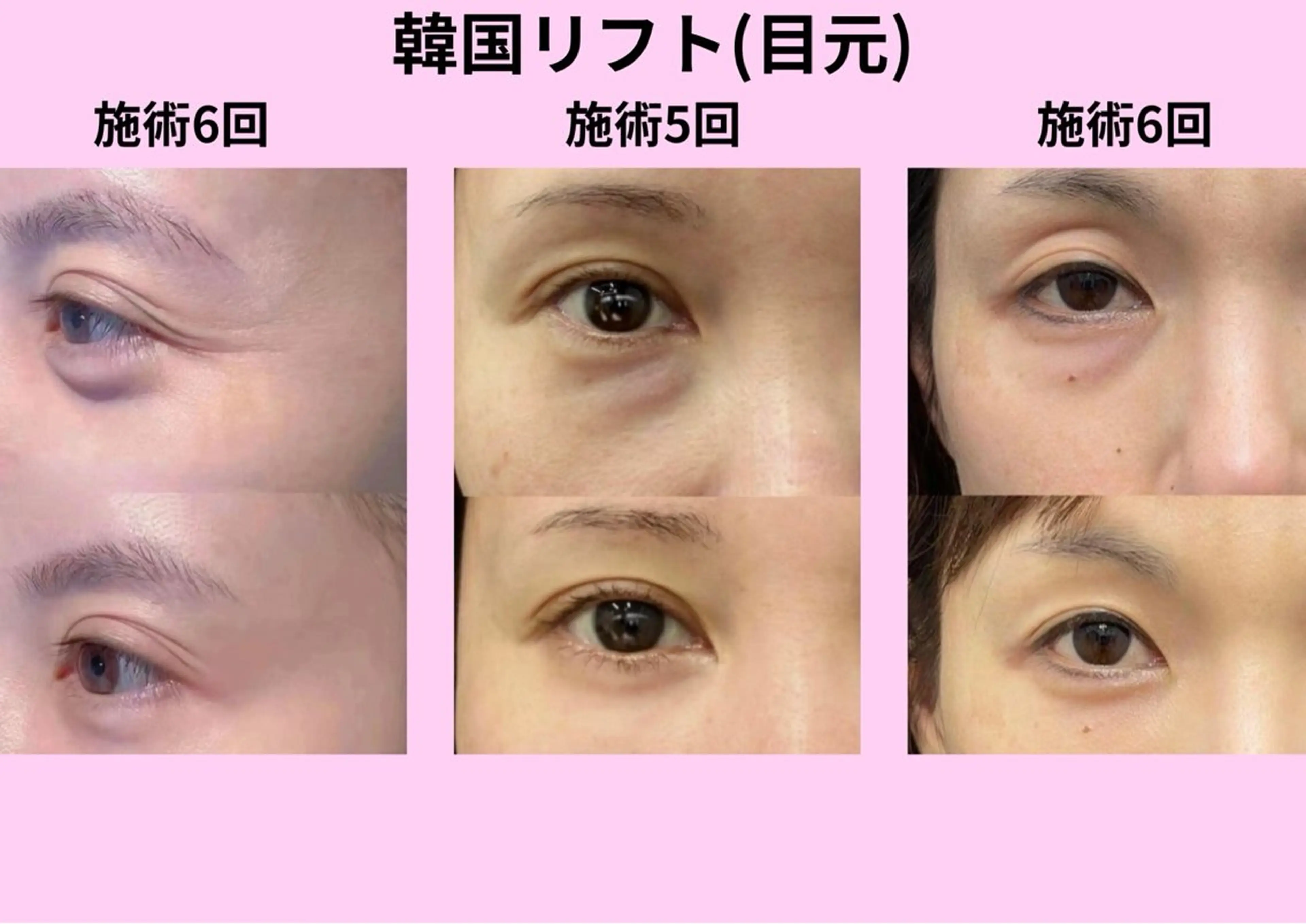 マツエク・マツパ エステ aliaハイフ&水光ジェットサロン所属・aliaハーブ水光店 エステティシャン募集のエステ・リラクイメージ