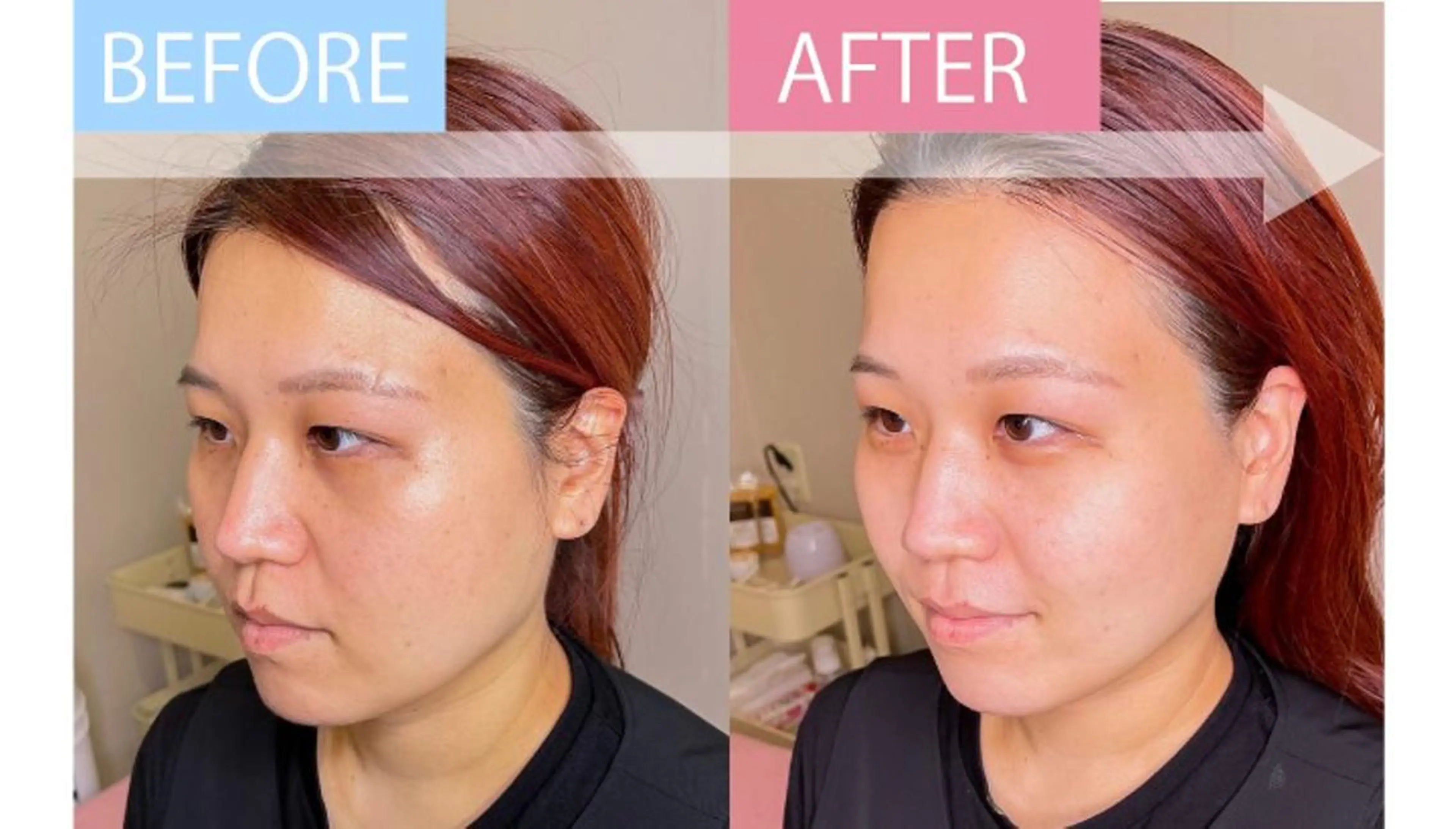 【リニューアルオープン価格】 FACE&眉デザイン&WAXの写真