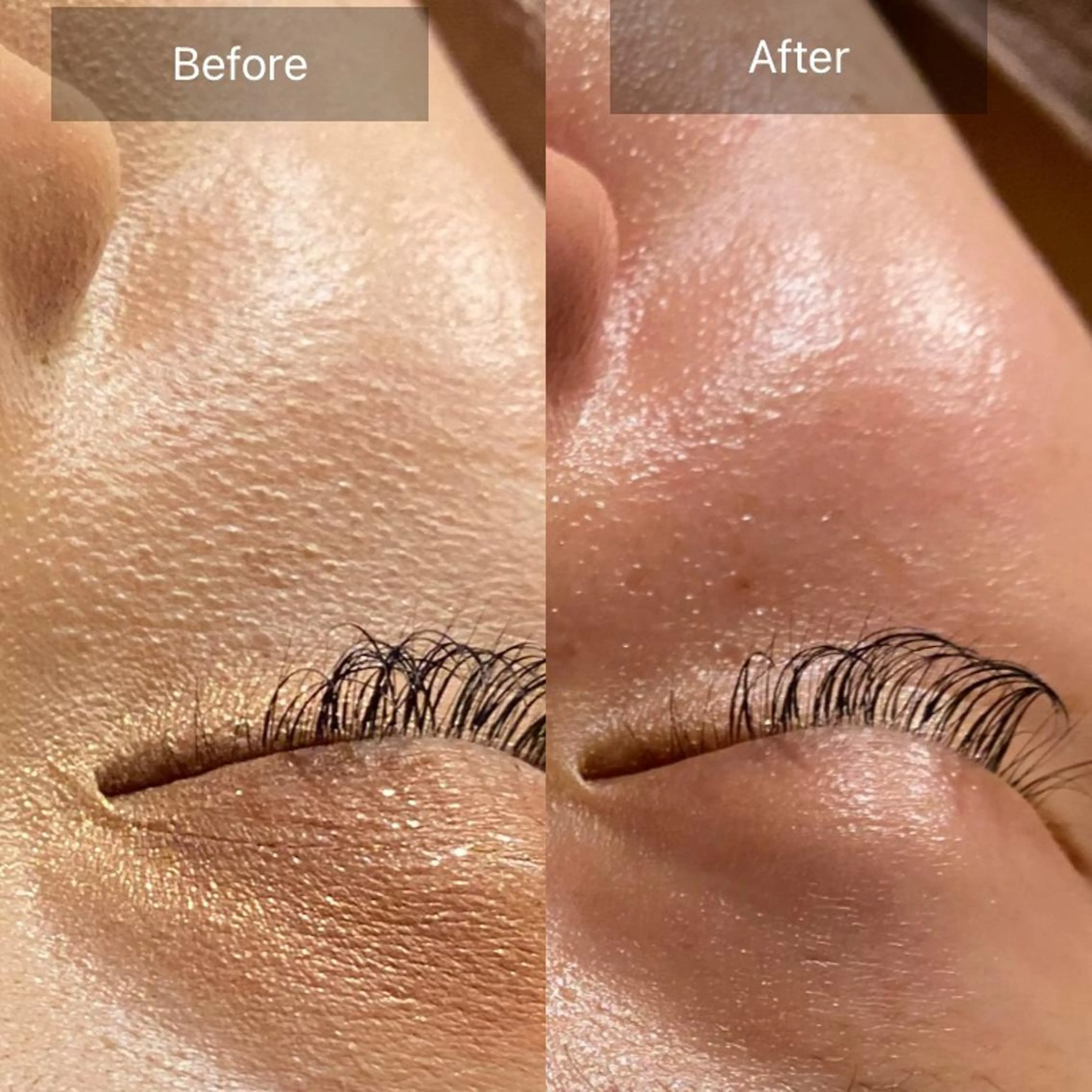 Mandarin Orange所属・毛穴から始める肌メン テマンダリンオレンジのエステ・リラクイメージ