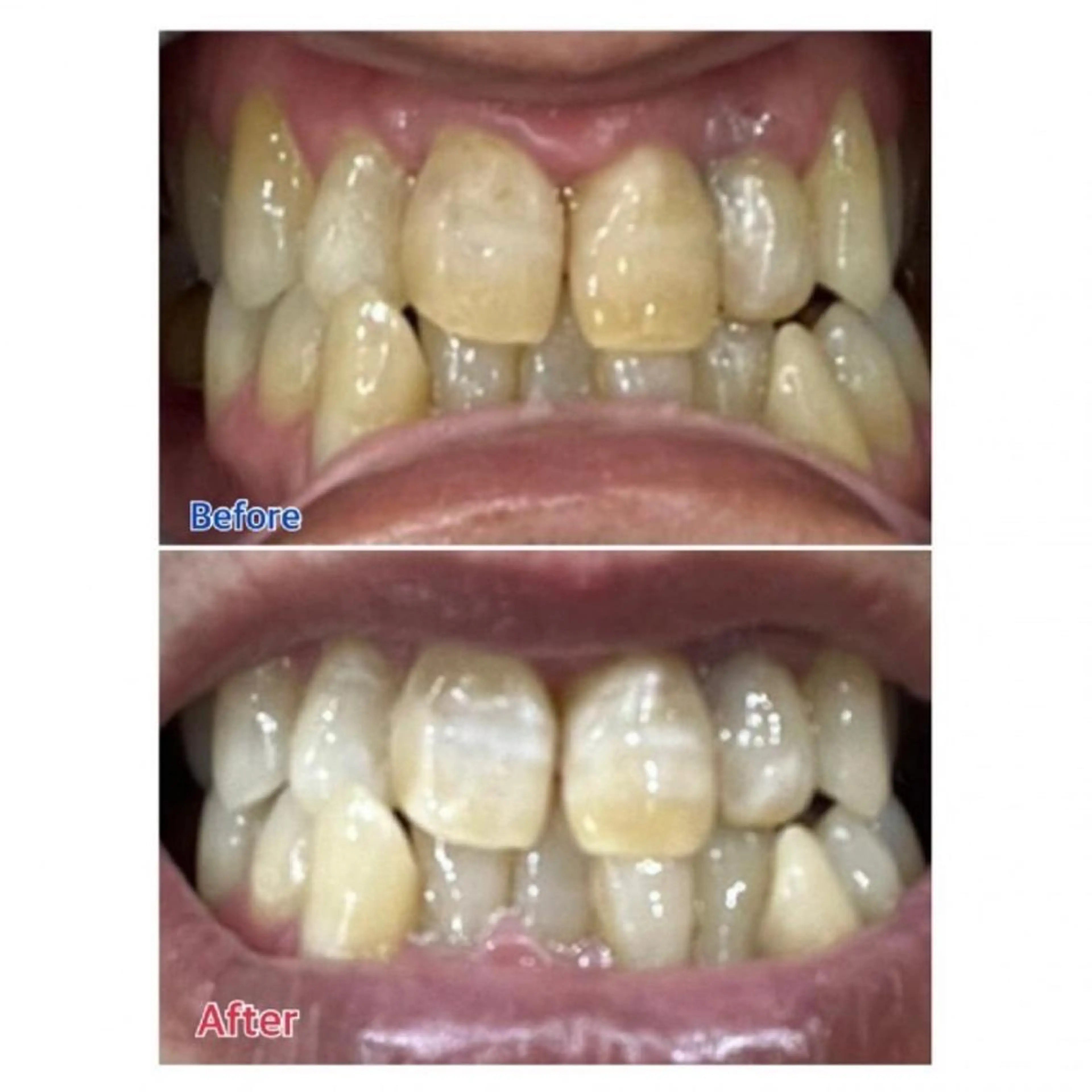 M渋谷店所属・M渋谷 ホワイトニングのエステ・リラクイメージ