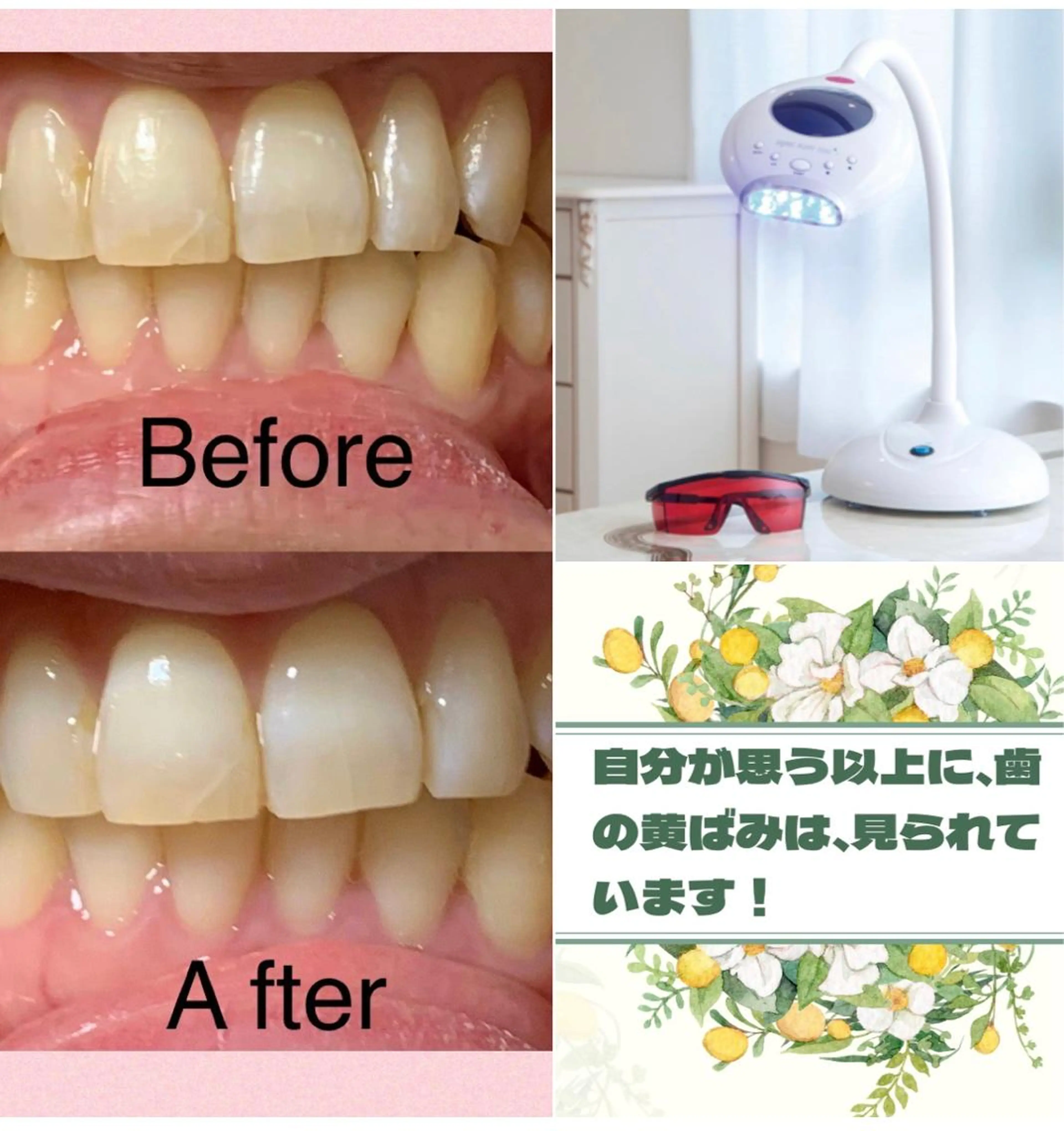 整体フェイシャル EMINALのエステ・リラクイメージ