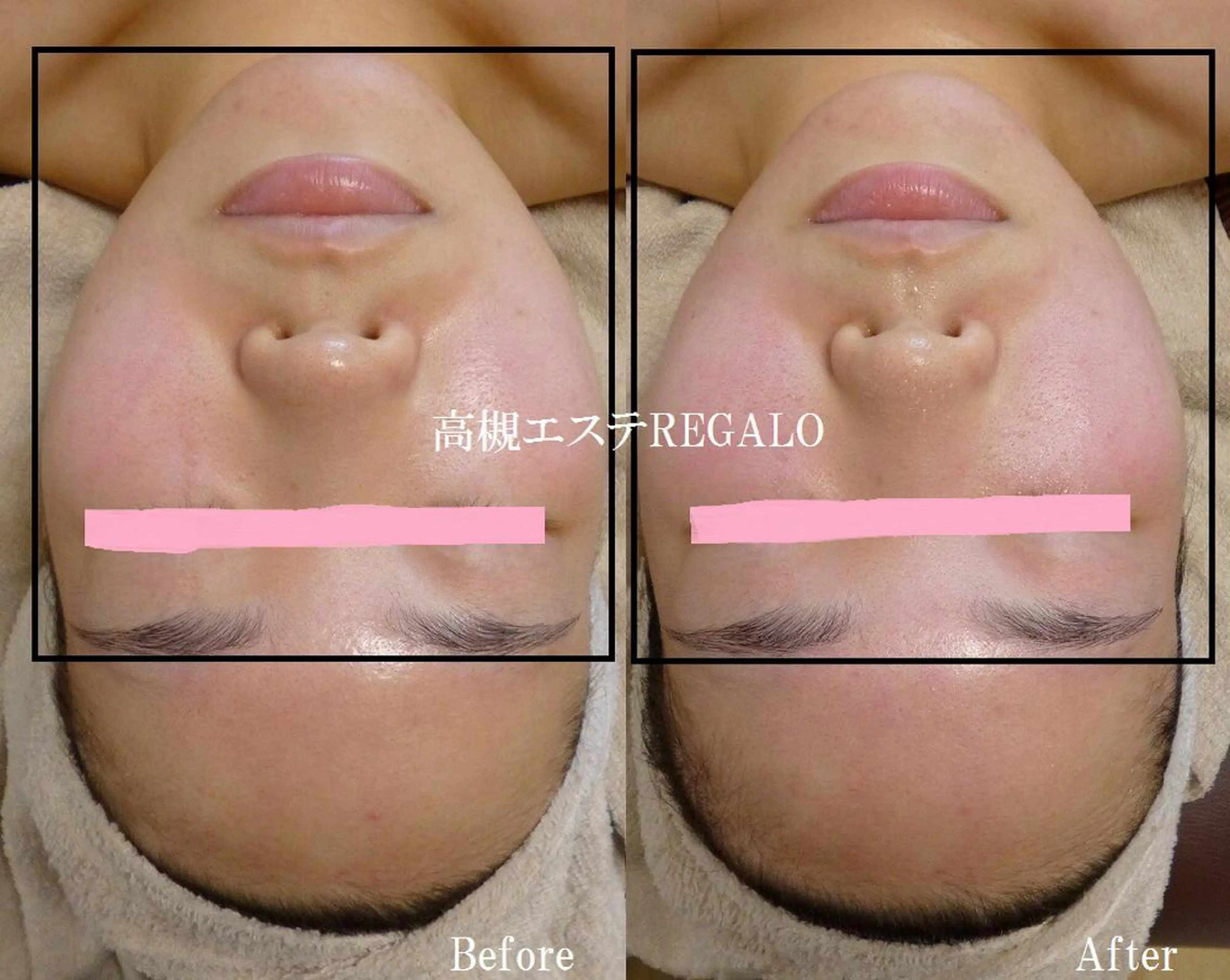 エステ REGALO所属・矢野 さやかのエステ・リラクイメージ