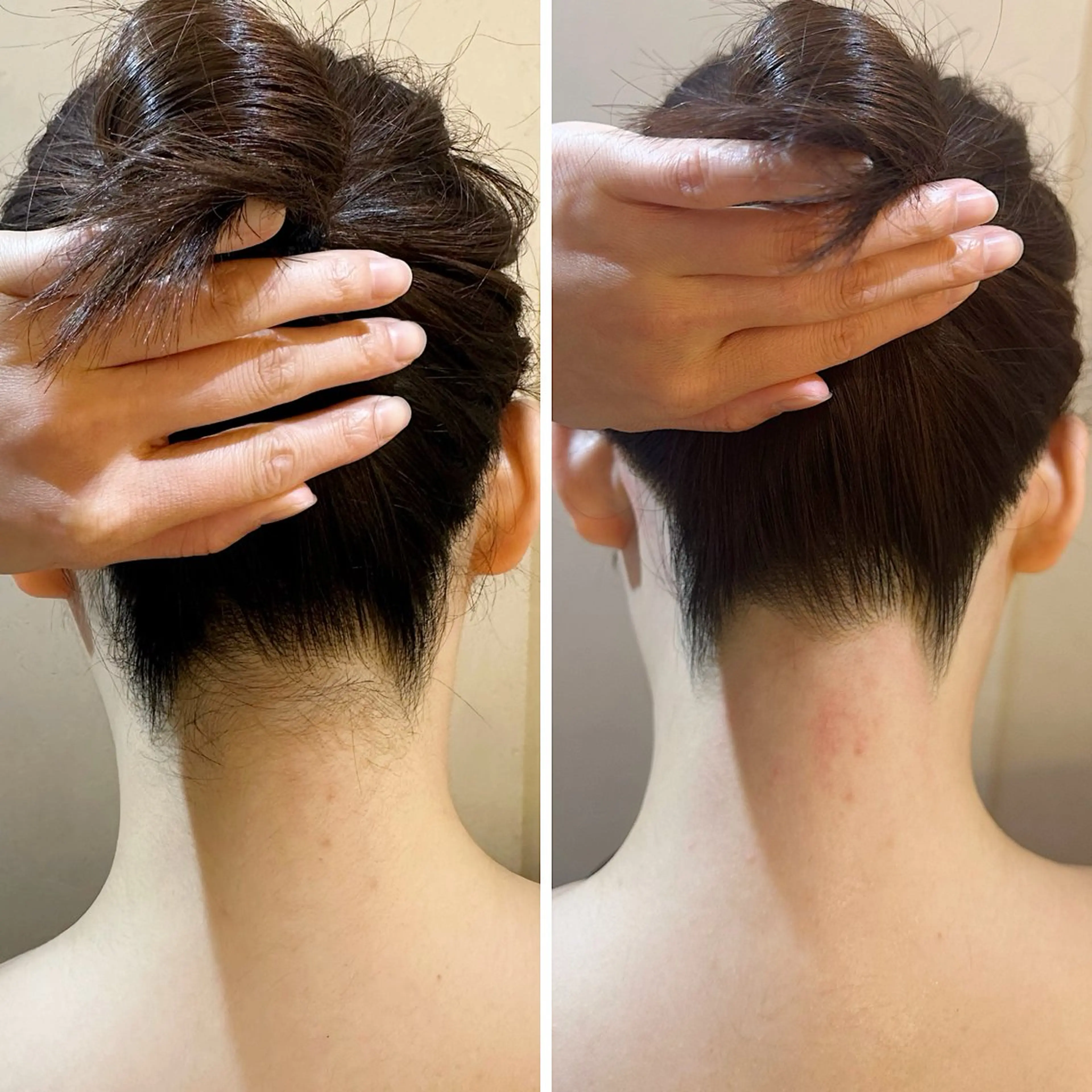 脱毛 うなじ脱毛/美肌脱毛 LABELのエステ・リラクイメージ