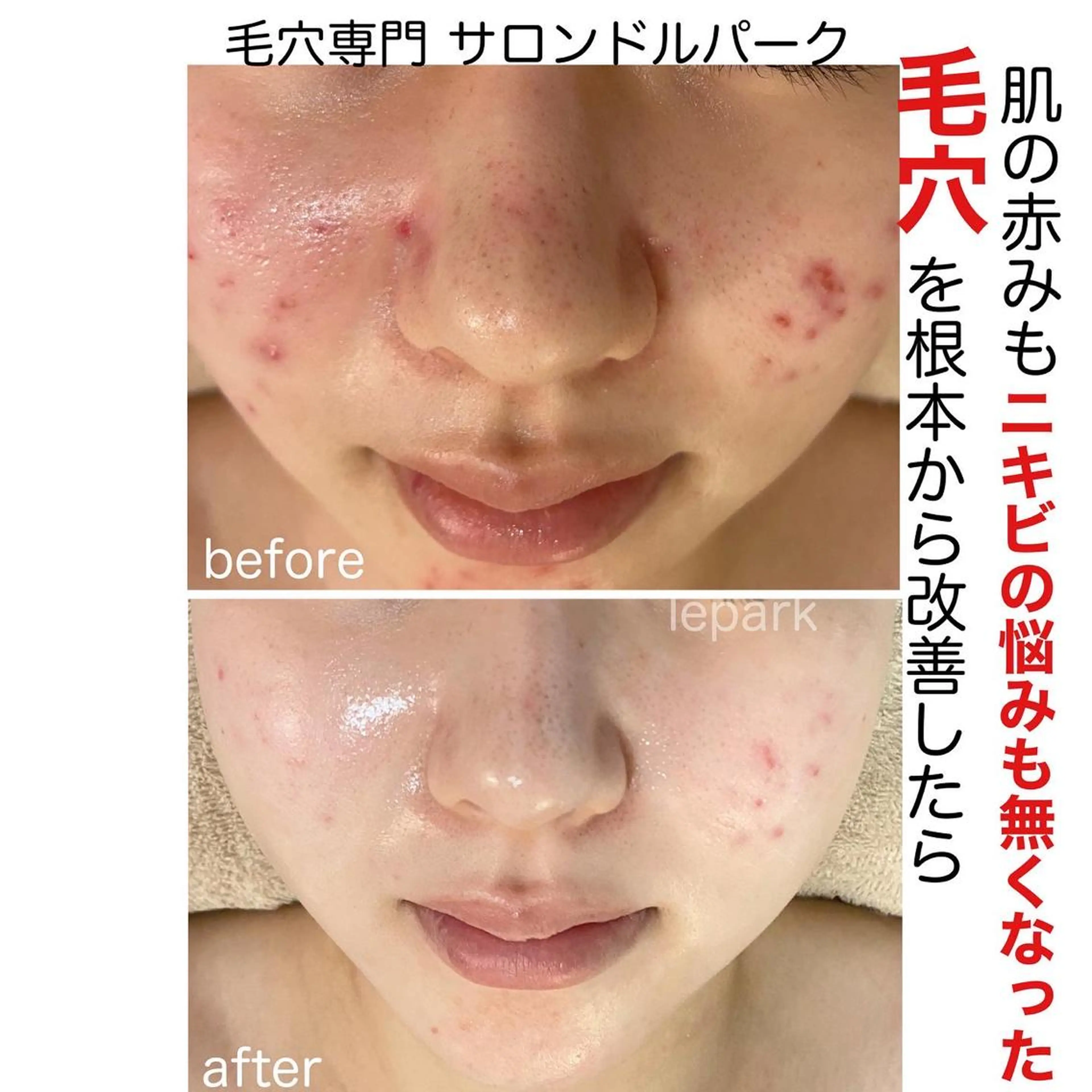 毛穴シミ改善専門 サロンド・ルパークのエステ・リラクイメージ