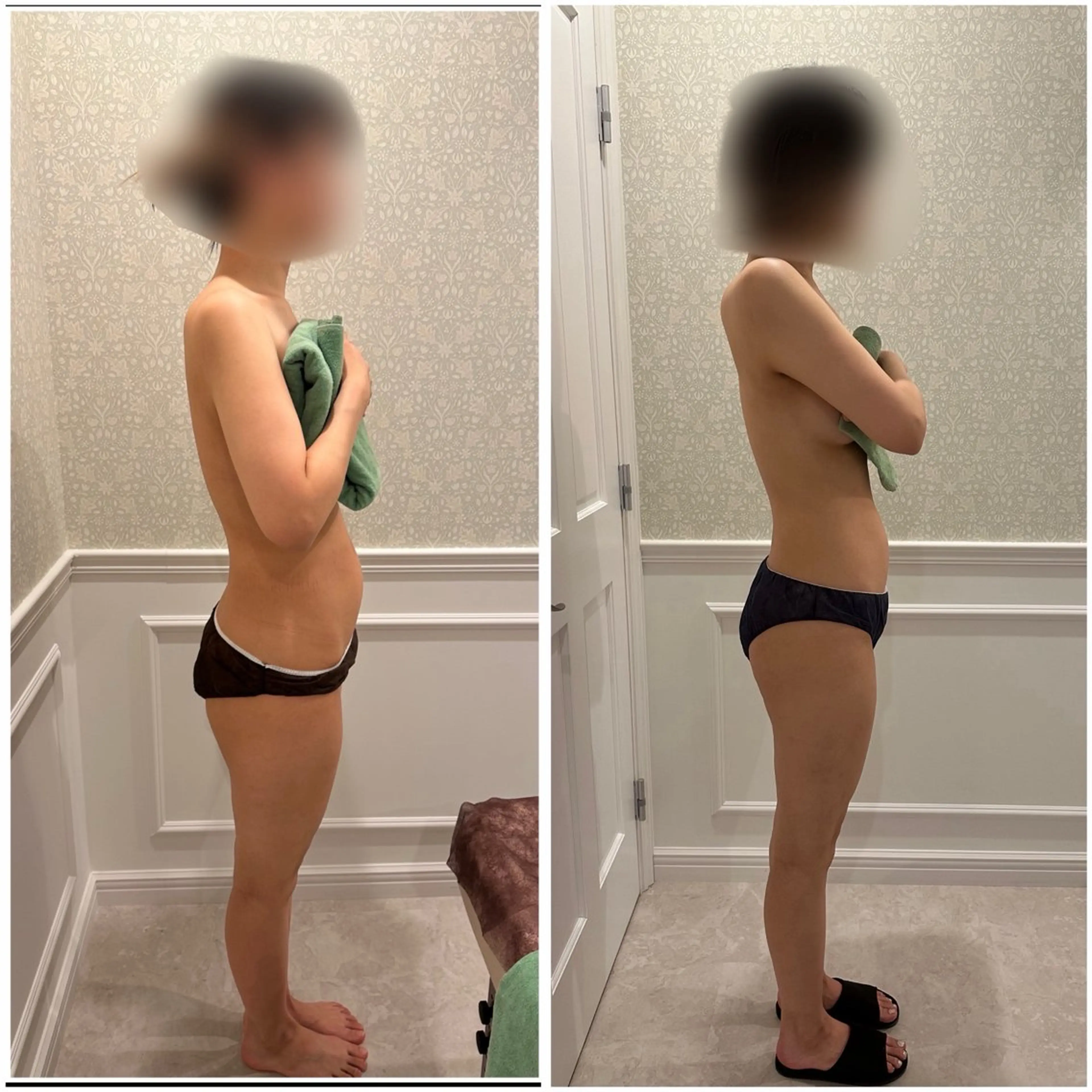 骨格改善‼️オイルリンパトリートメント【太もものセルライト】【O脚改善】【美脚尻】✨️の写真