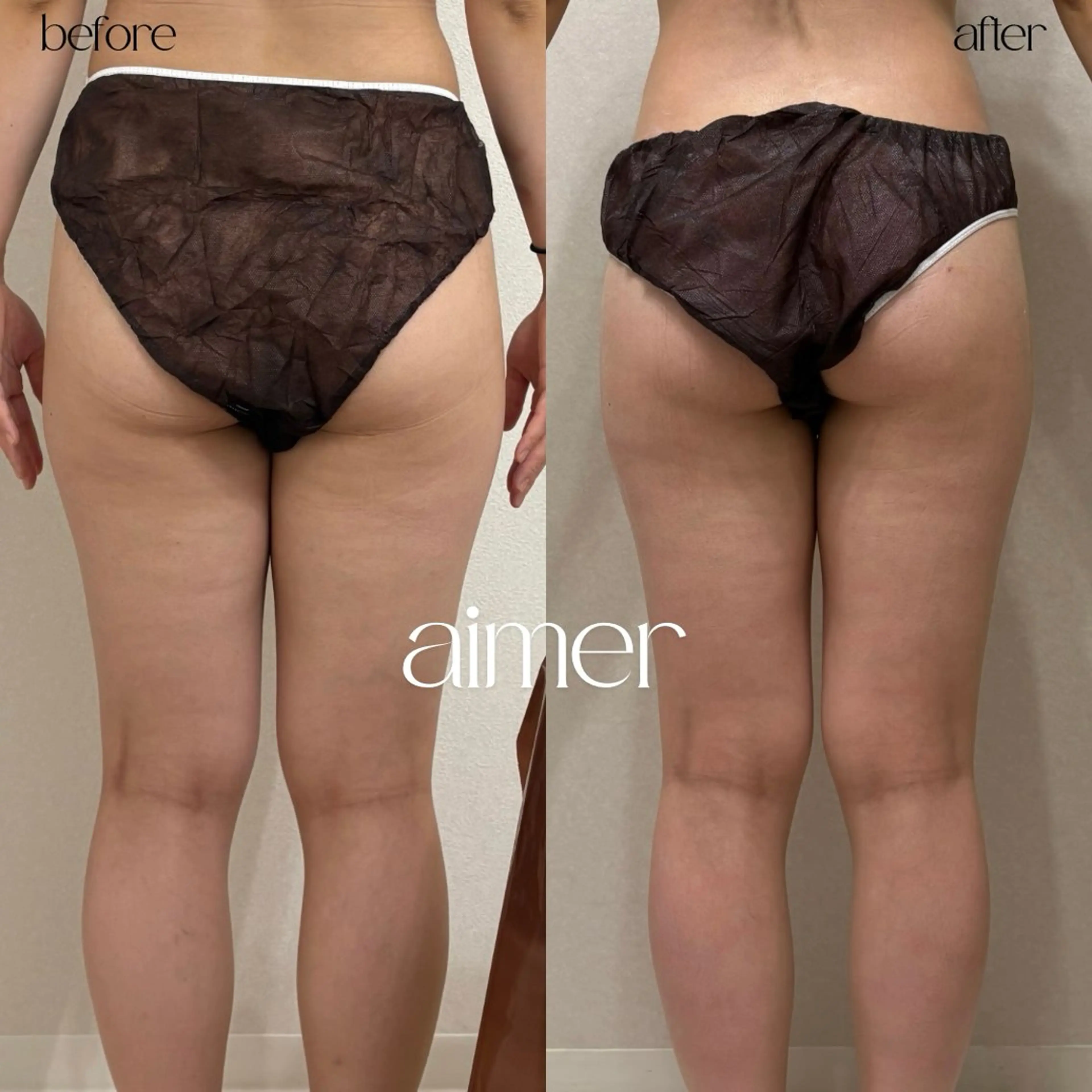 aimer 島田のエステ・リラクイメージ