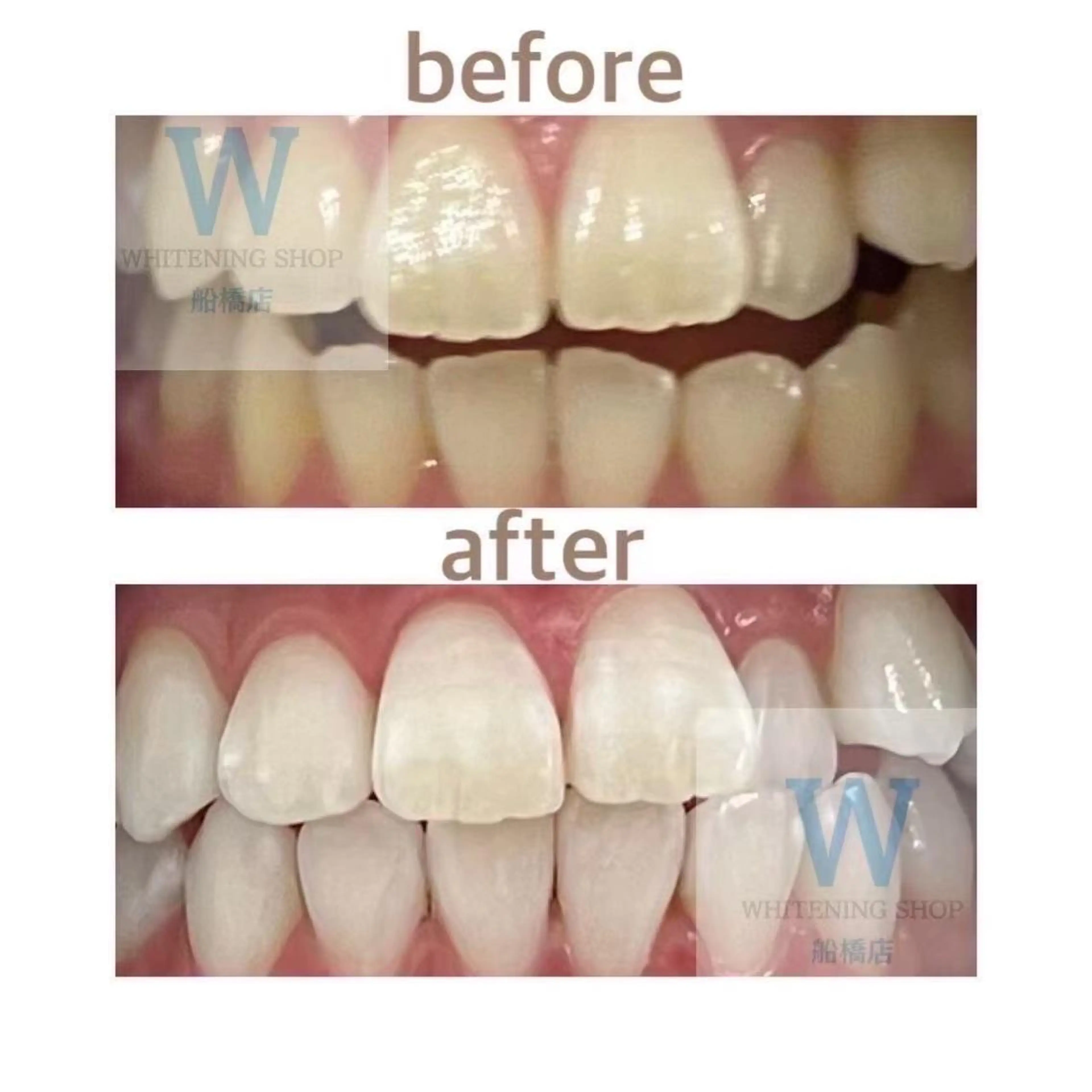 エステ リラク ホワイトニング ショップ船橋２号店のエステ・リラクイメージ