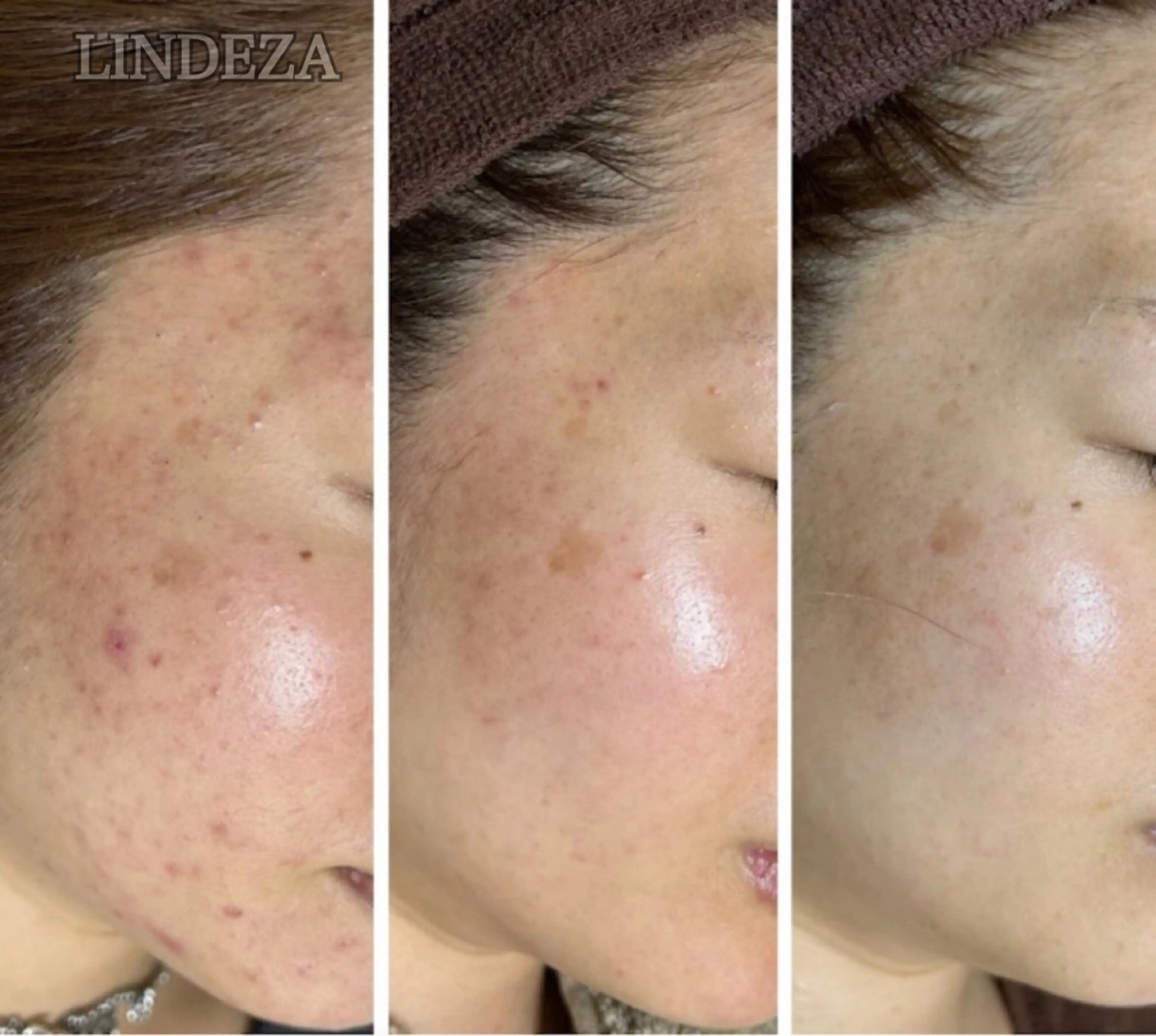 private salon 𝐋𝐈𝐍𝐃𝐄𝐙𝐀所属・LINDEZA Ayaのエステ・リラクイメージ