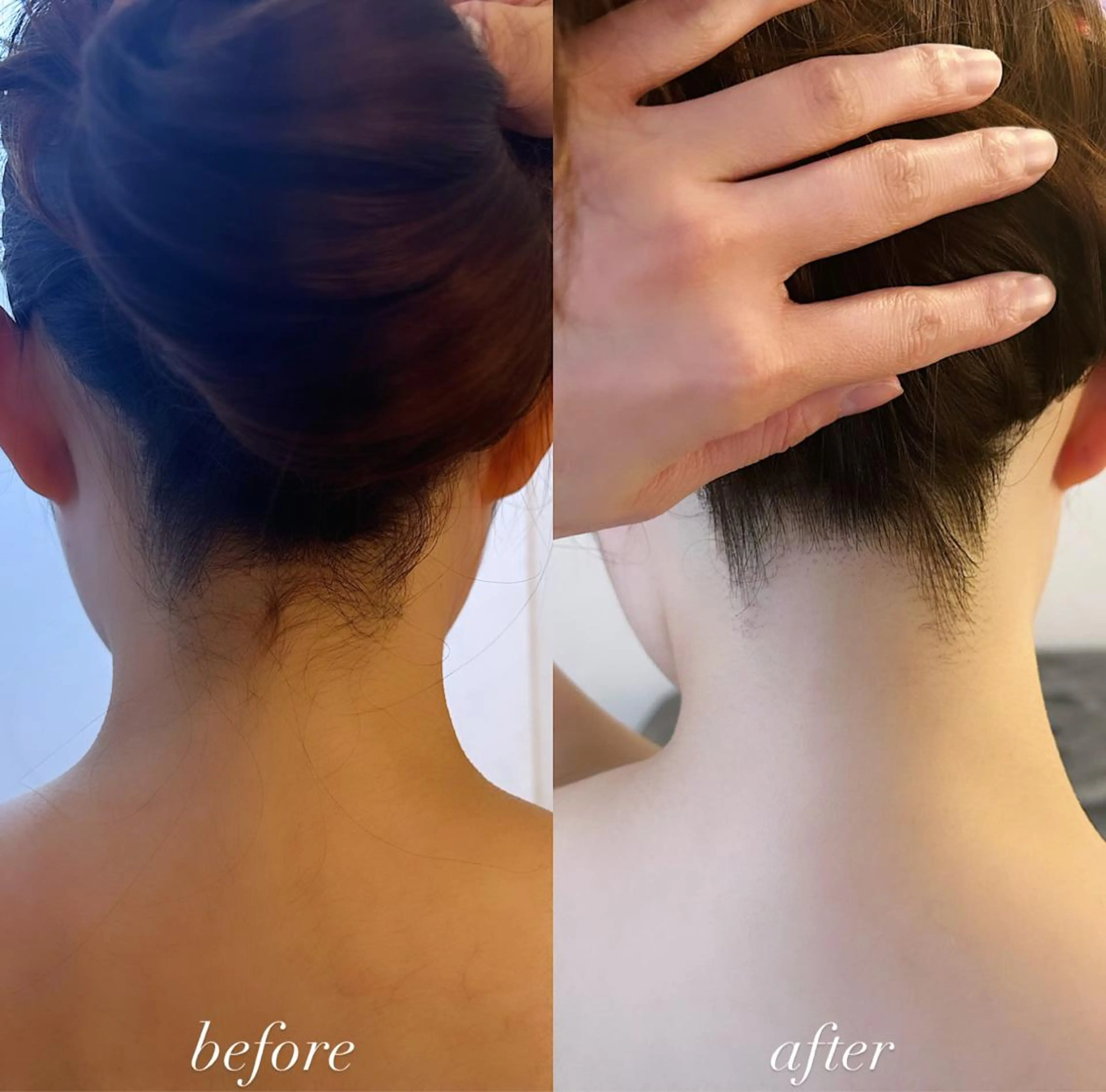 脱毛 うなじ脱毛/美肌脱毛 LABELのエステ・リラクイメージ