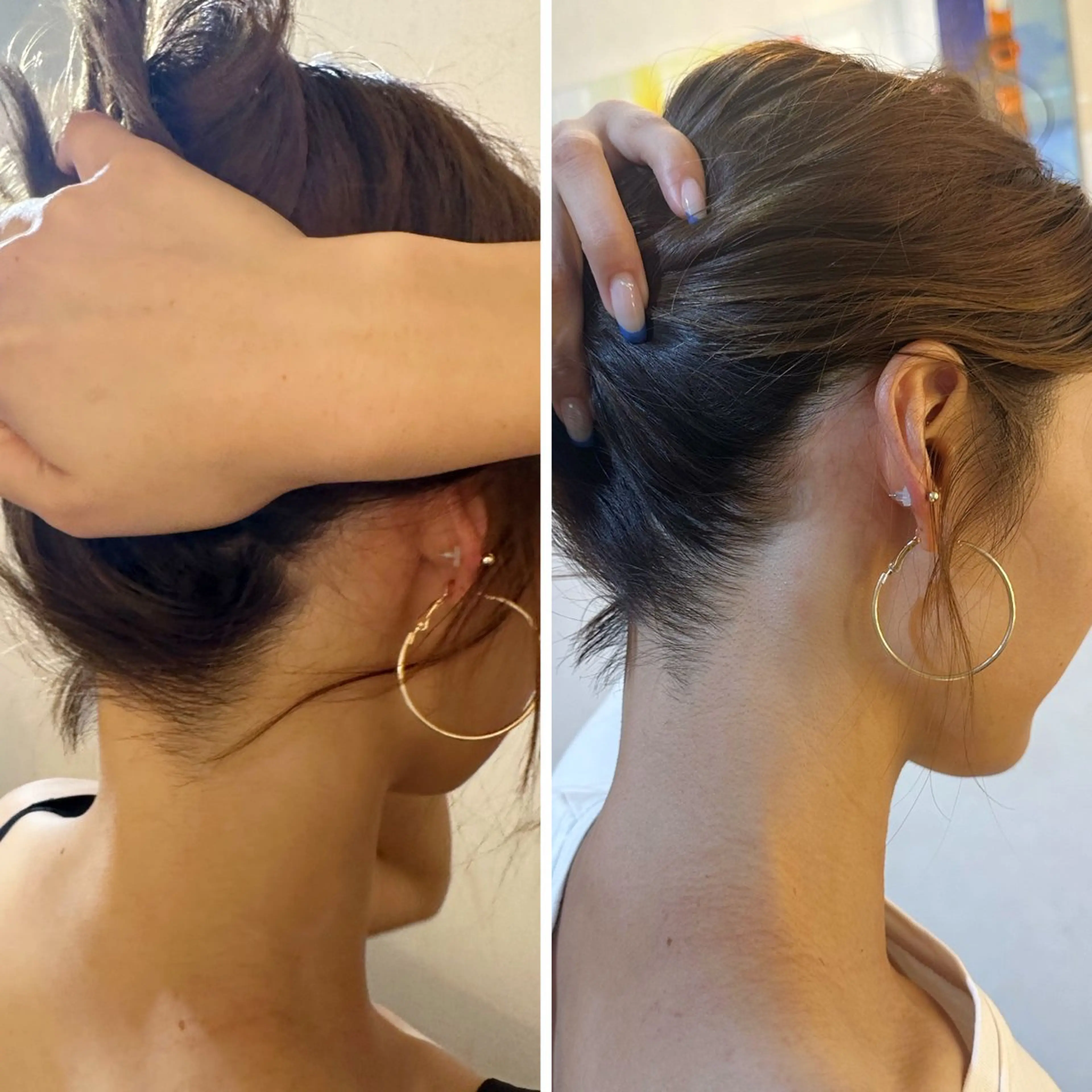 脱毛 うなじ脱毛/美肌脱毛 LABELのエステ・リラクイメージ