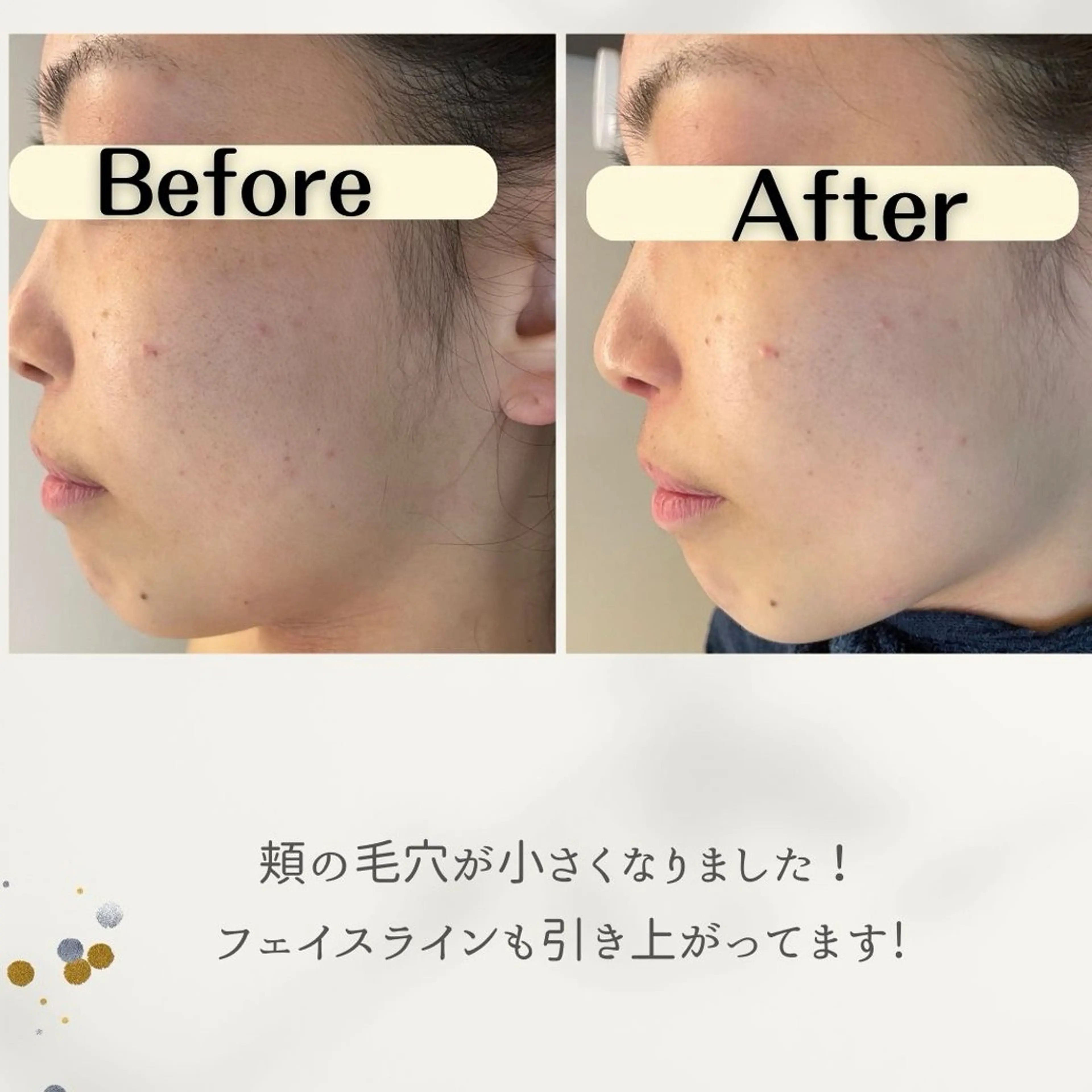 お肌と歯のサロン　Sona Mior所属・藤井 ののみのエステ・リラクイメージ