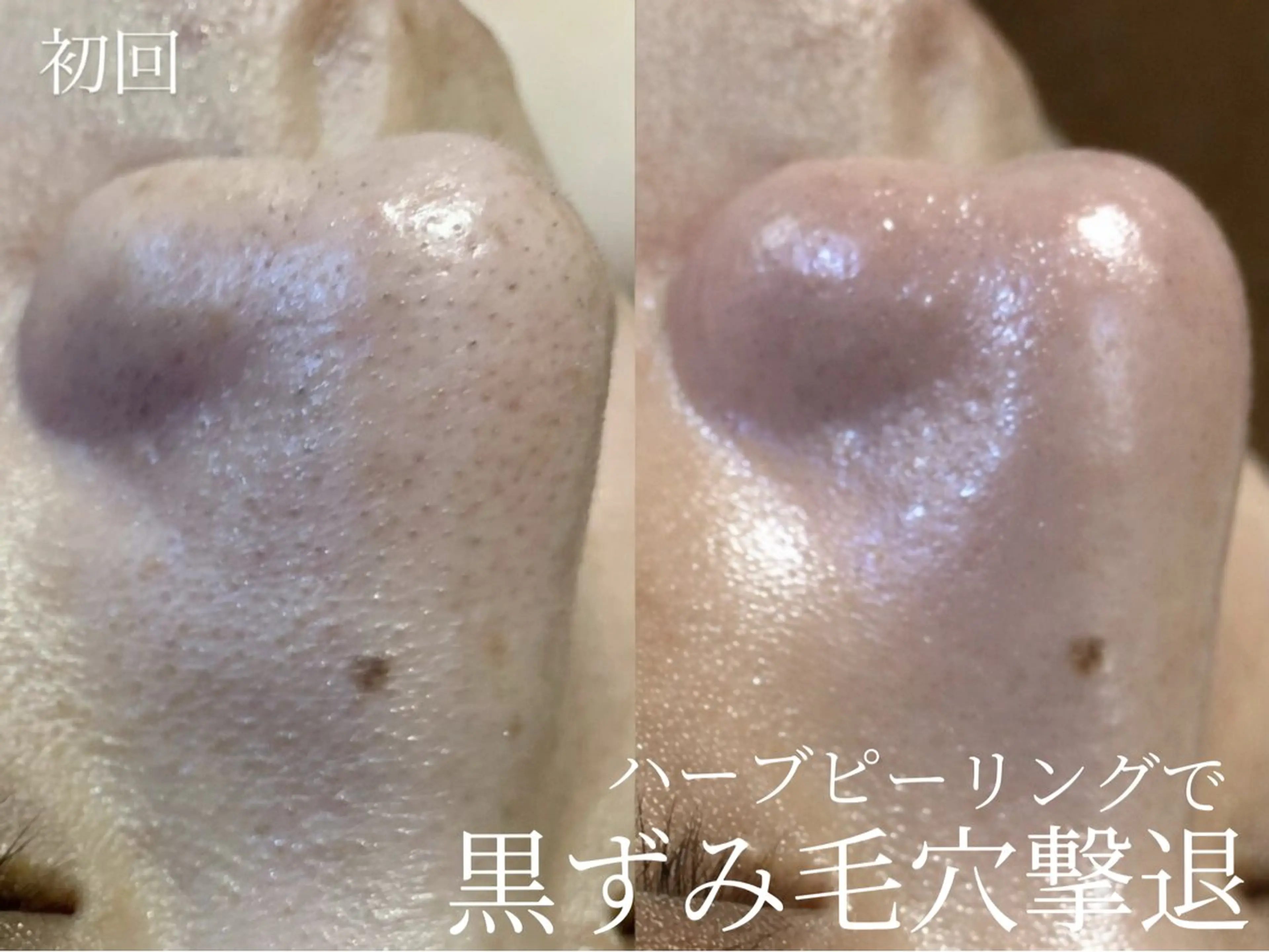 エステ foi sayaのエステ・リラクイメージ