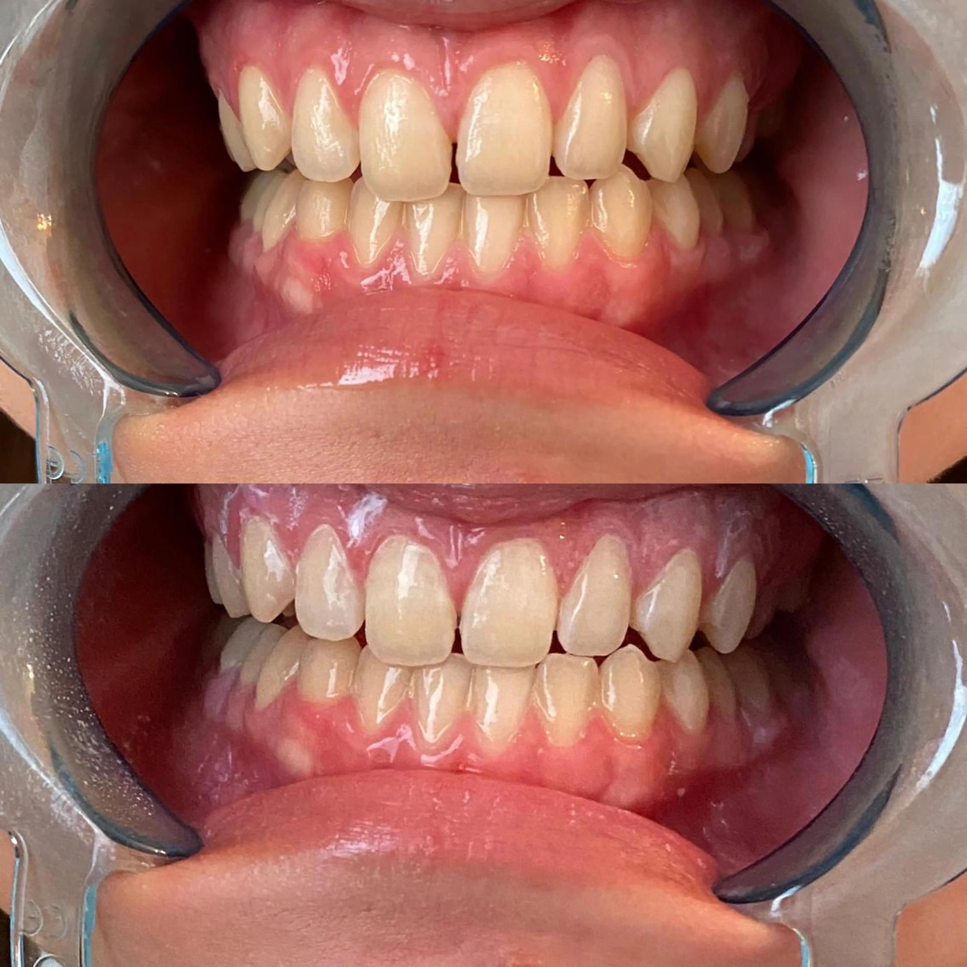 R E O T I A R A（レオティアラ）所属・高屋 昌子のその他イメージ