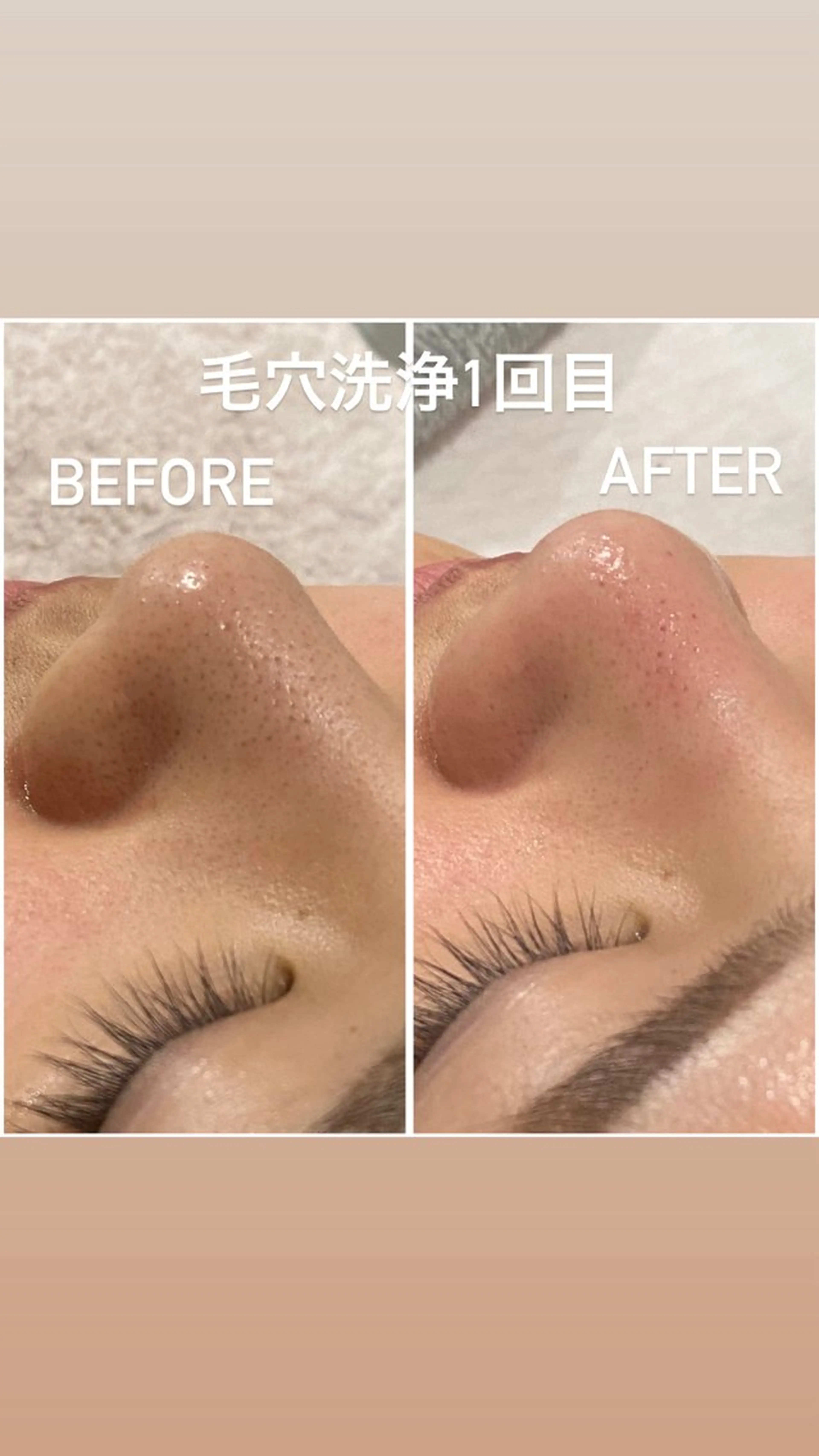 エステ 毛穴洗浄・痩身・脱毛 /アルカンジュのエステ・リラクイメージ