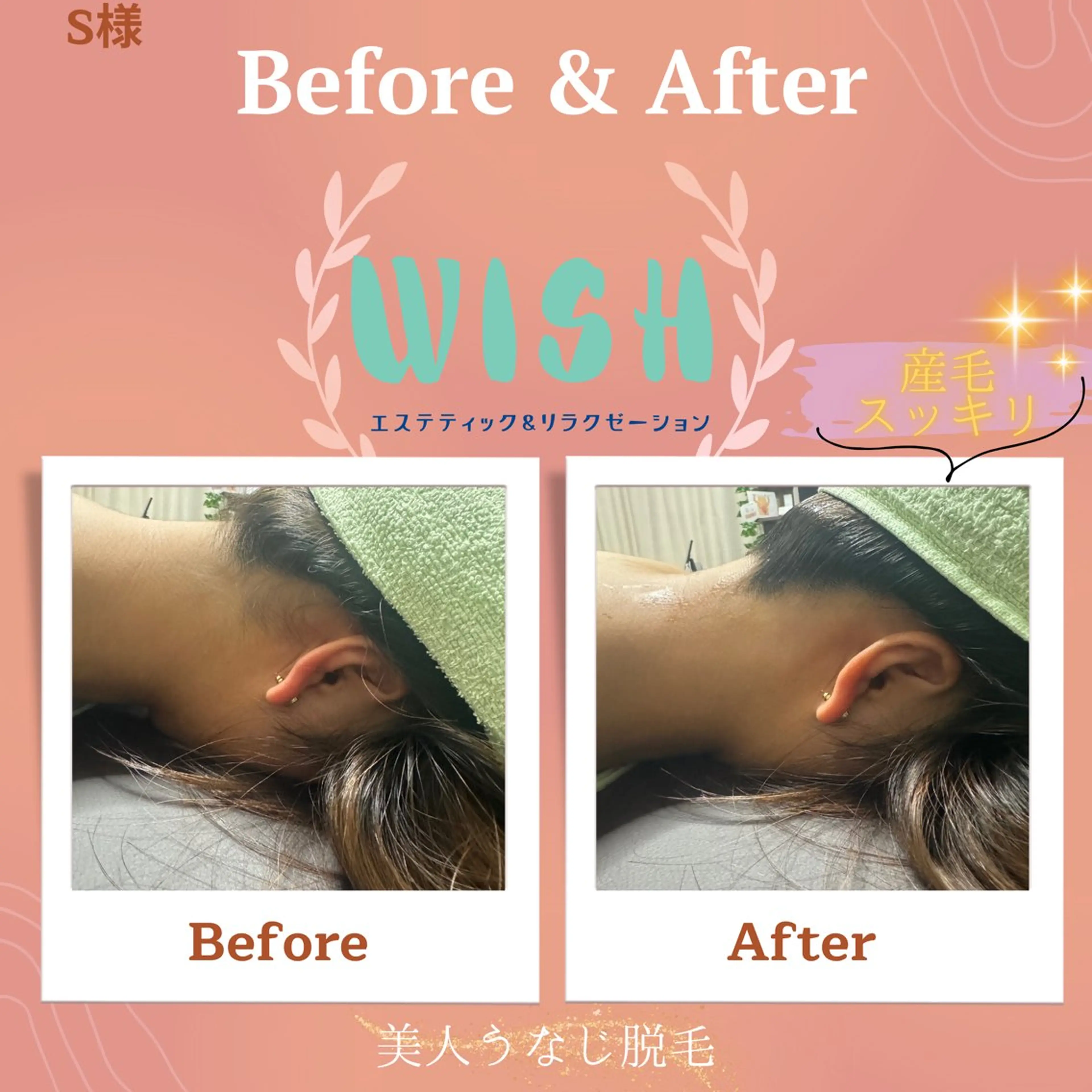 WISH 美肌脱毛のプロ！須藤のエステ・リラクイメージ