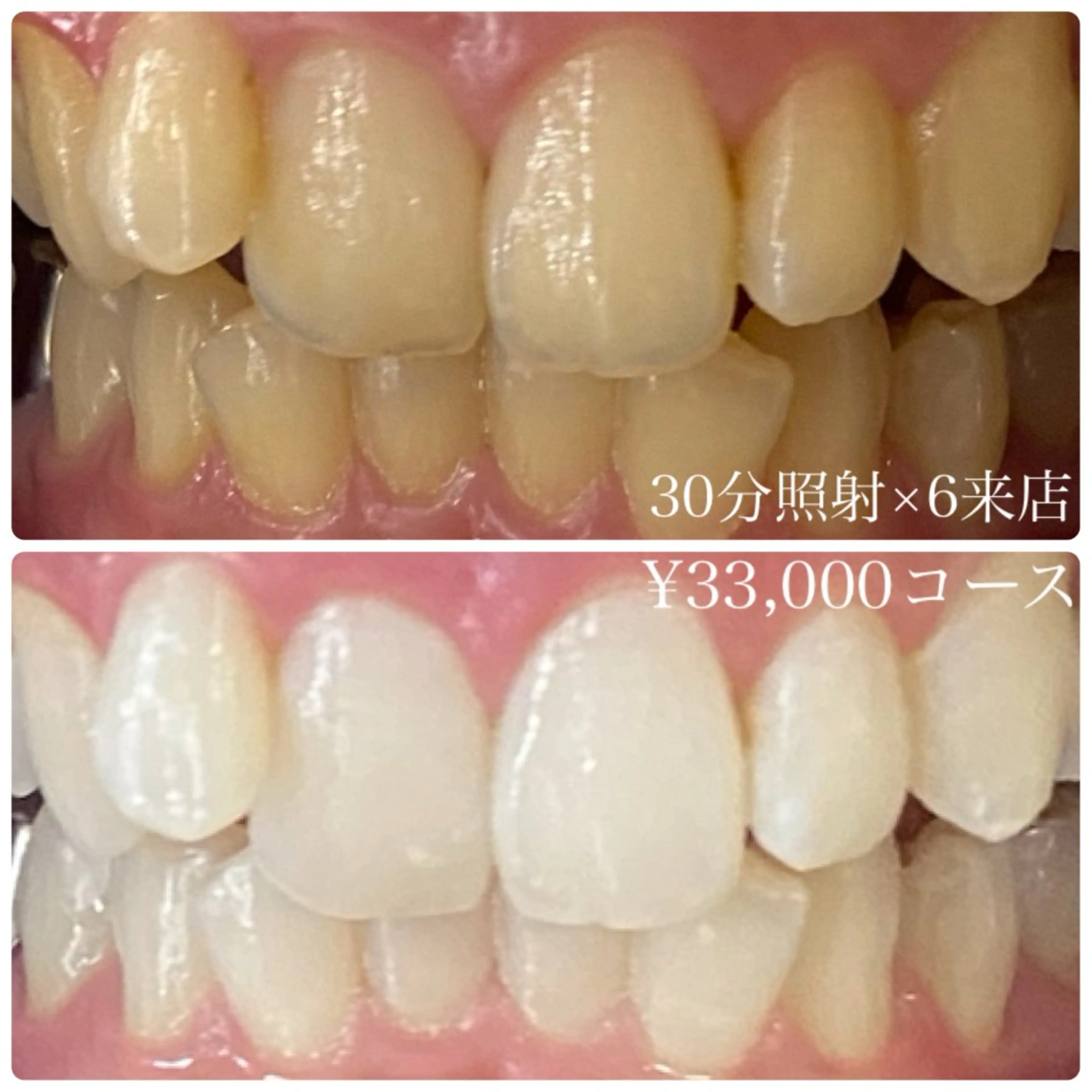 メンズ その他 ホワイトニングルーム　川崎店所属・ホワイトニング ルーム　川崎店のその他イメージ