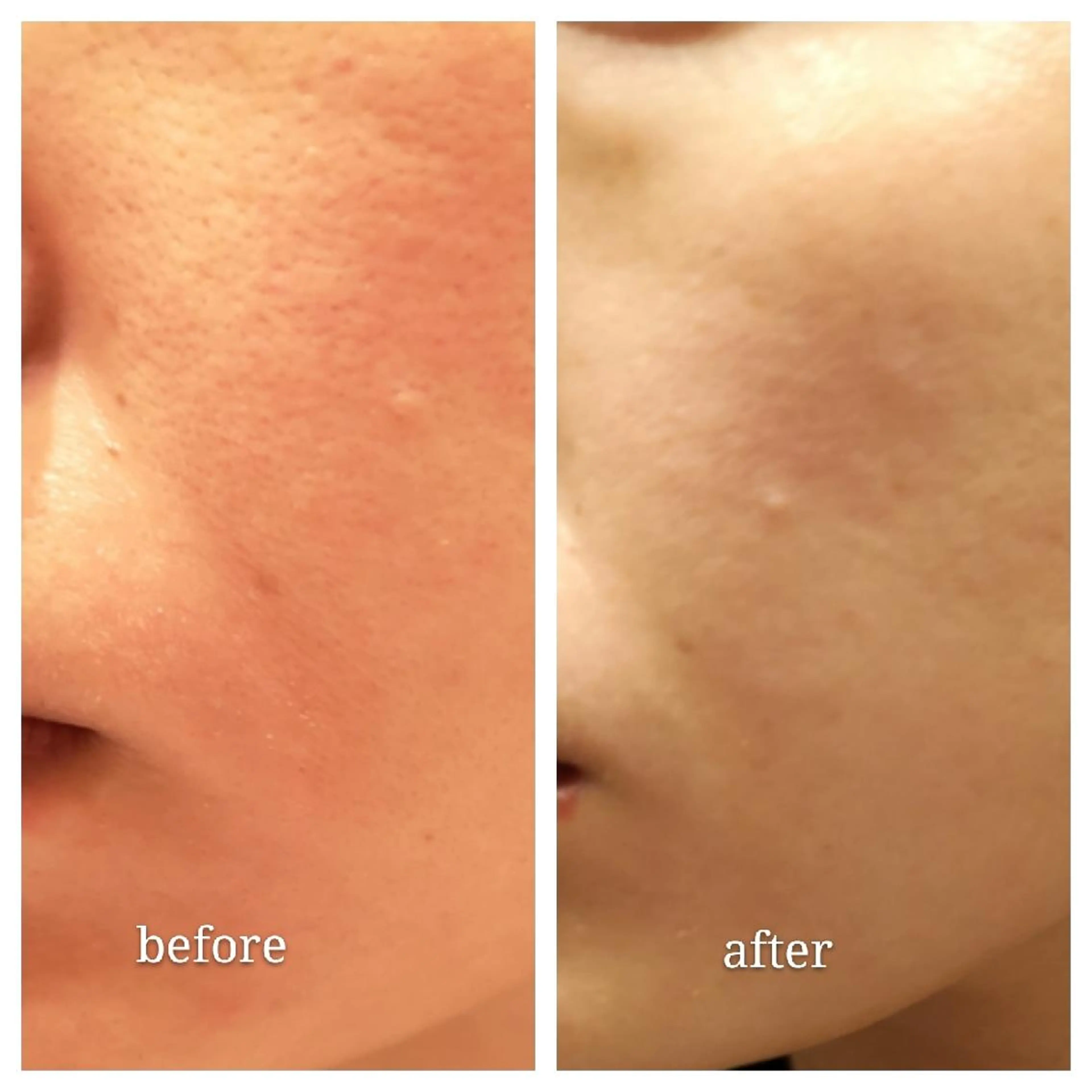 🅖🅤🅩🅔🅛 salonのエステ・リラクイメージ