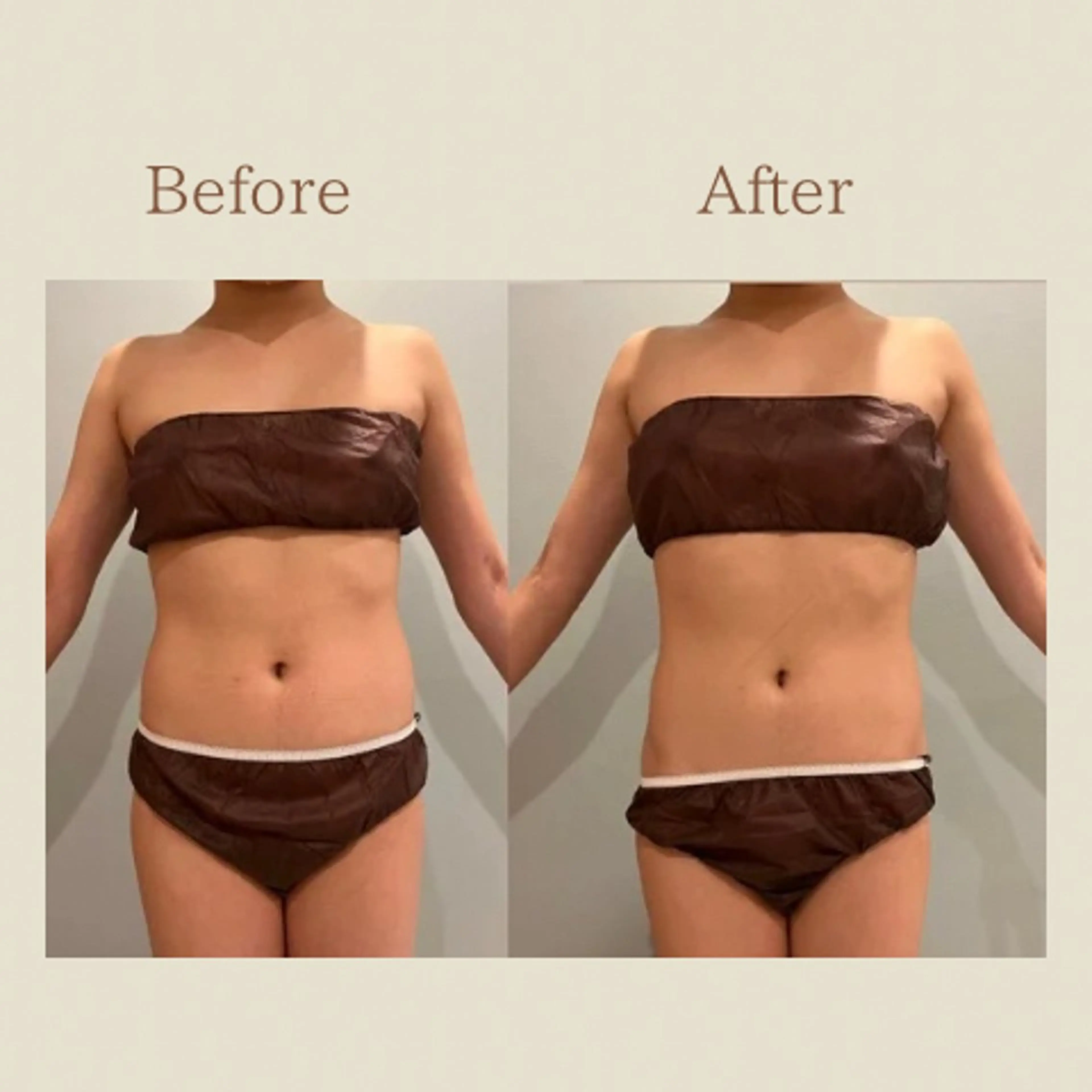 お腹痩せエステ Flat BELLY 恵比寿所属・【腸もみ/冷却痩身】 お腹エステ/恵比寿のエステ・リラクイメージ