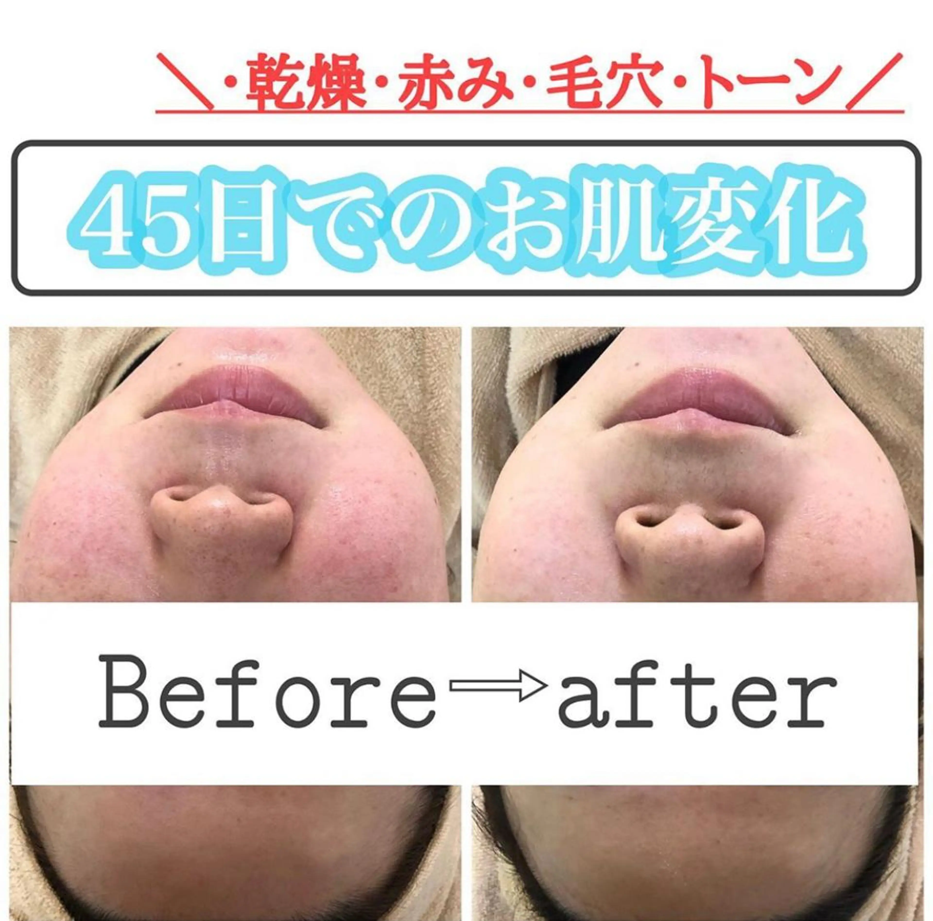 ショート カラー パーマ ヘアアレンジ メンズ キッズ ネイル マツエク・マツパ エステ ニキビ&跡改善サロン オーナー光木のエステ・リラクイメージ