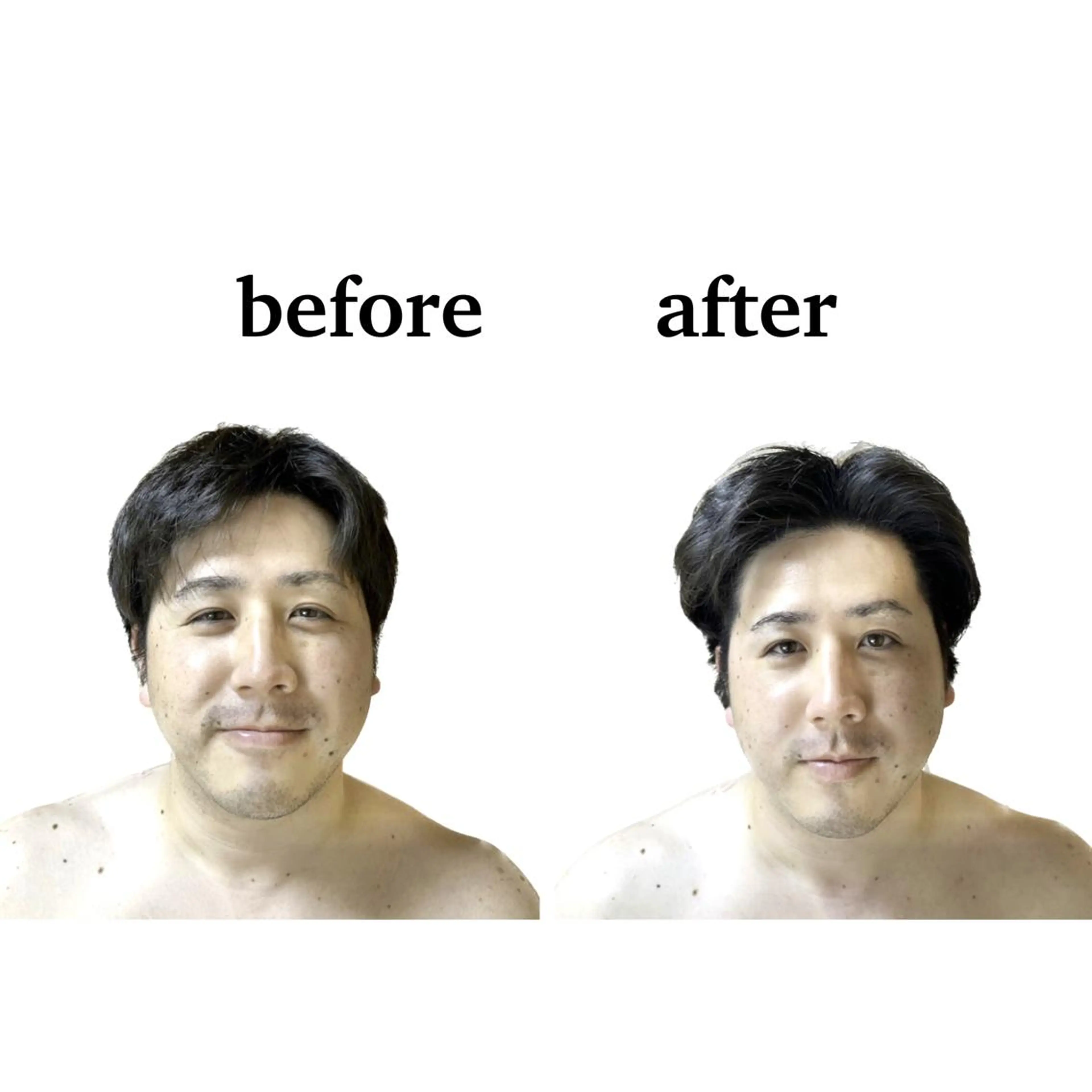 エステ stella所属・stella都度払い 痩身小顔まつげパーマのマツエク・マツパデザイン