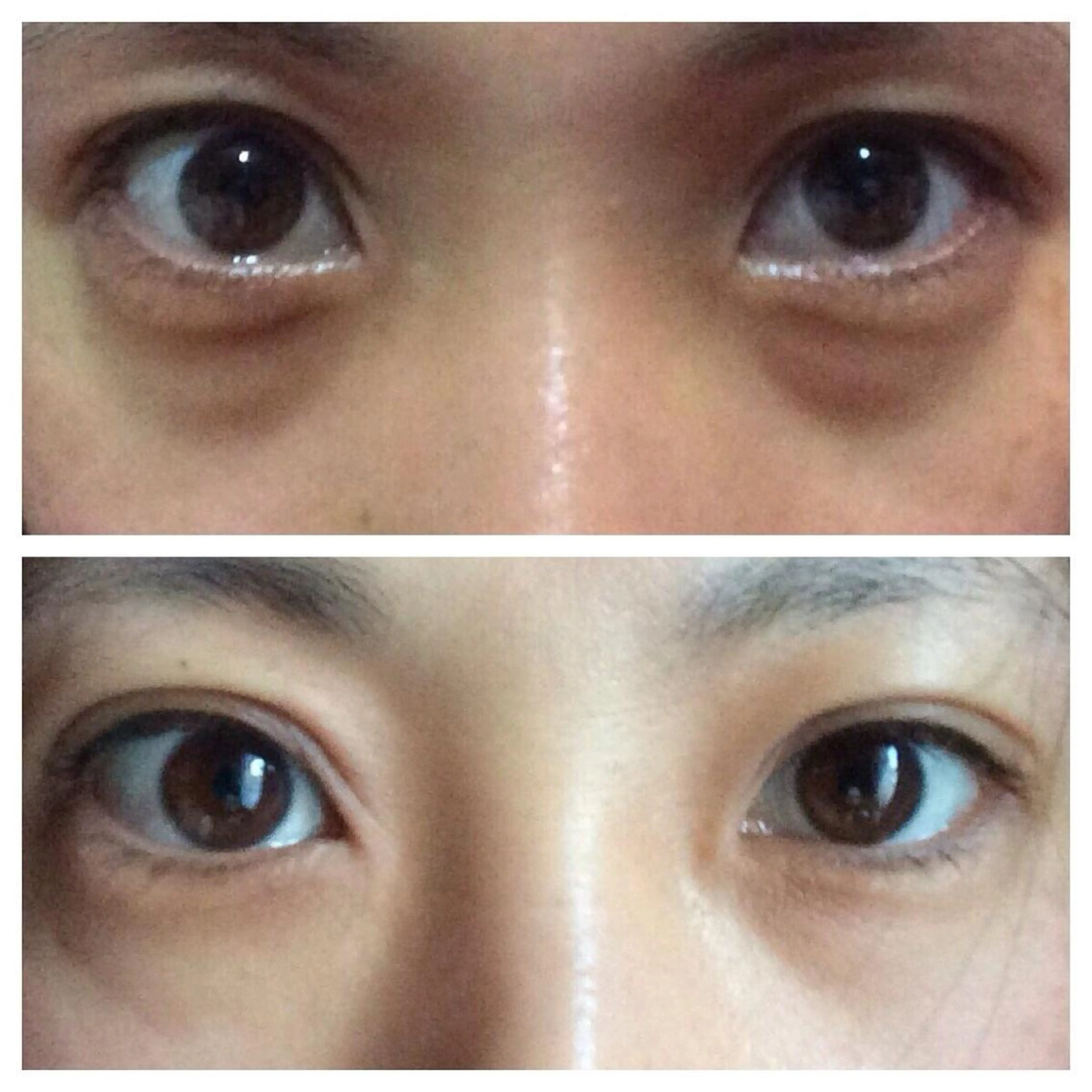 【目の下のたるみ、くま撃退】フェイシャルコース60分の写真