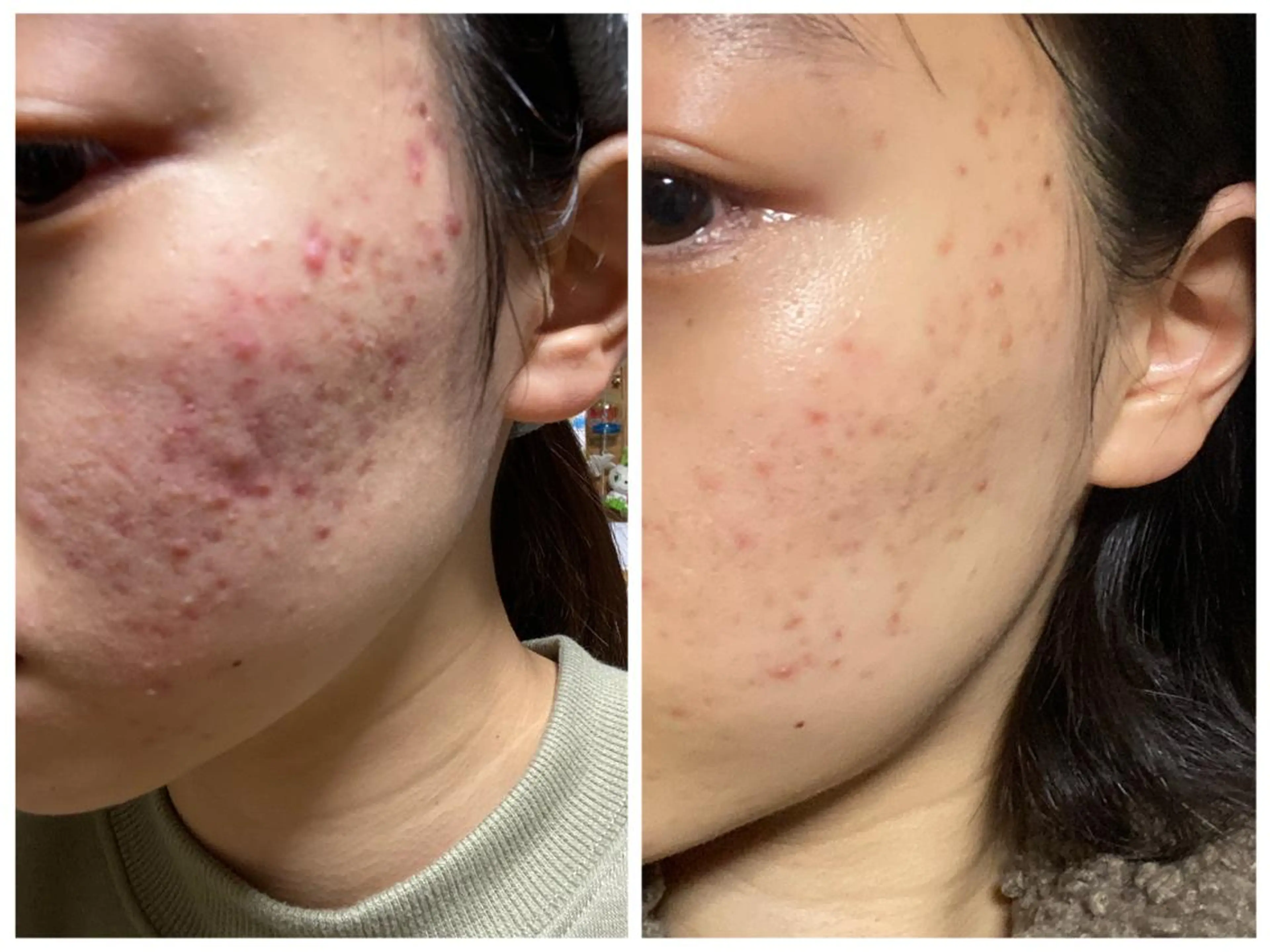 <フェイシャル>小顔、ツヤ肌へ✨エイジングスペシャルコースの写真