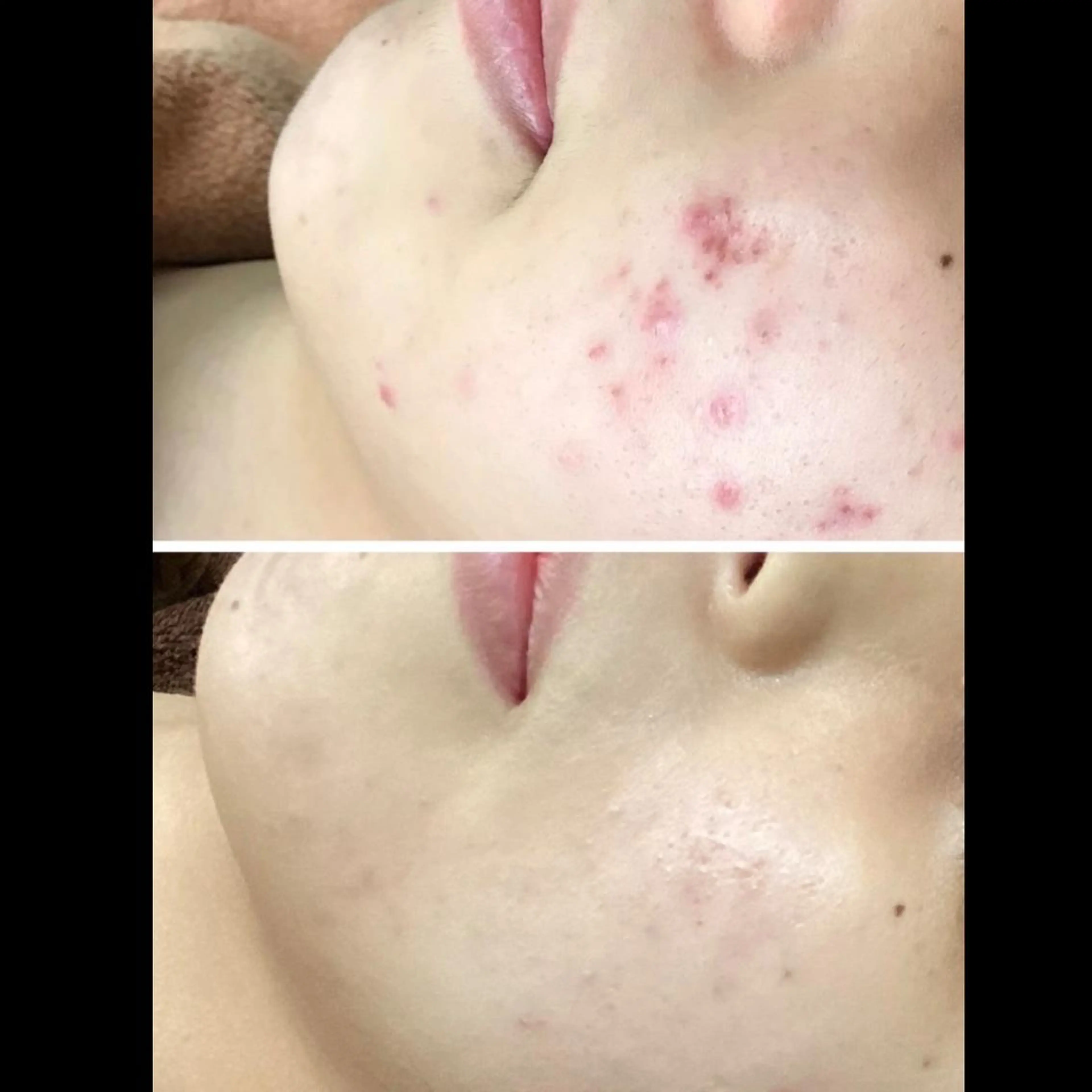 エステ リラク NON-NONプラス 大人の本気痩身のエステ・リラクイメージ